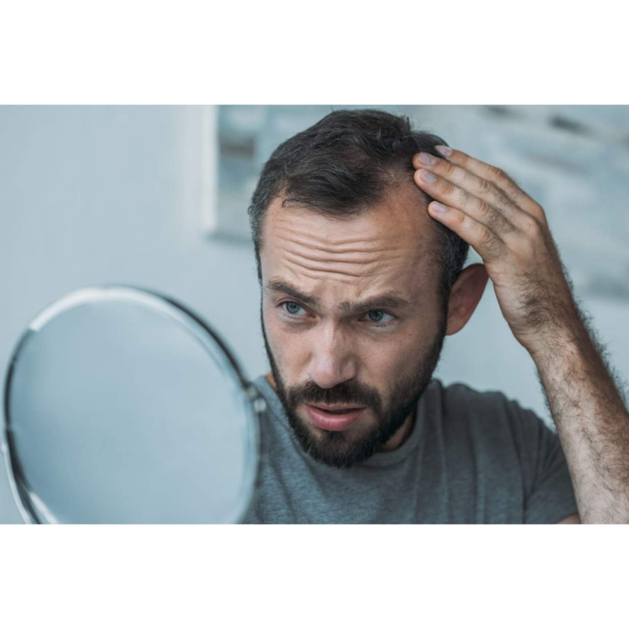 Prevenir la caída del cabello en Barcelona con el Dr. Carlos Zito