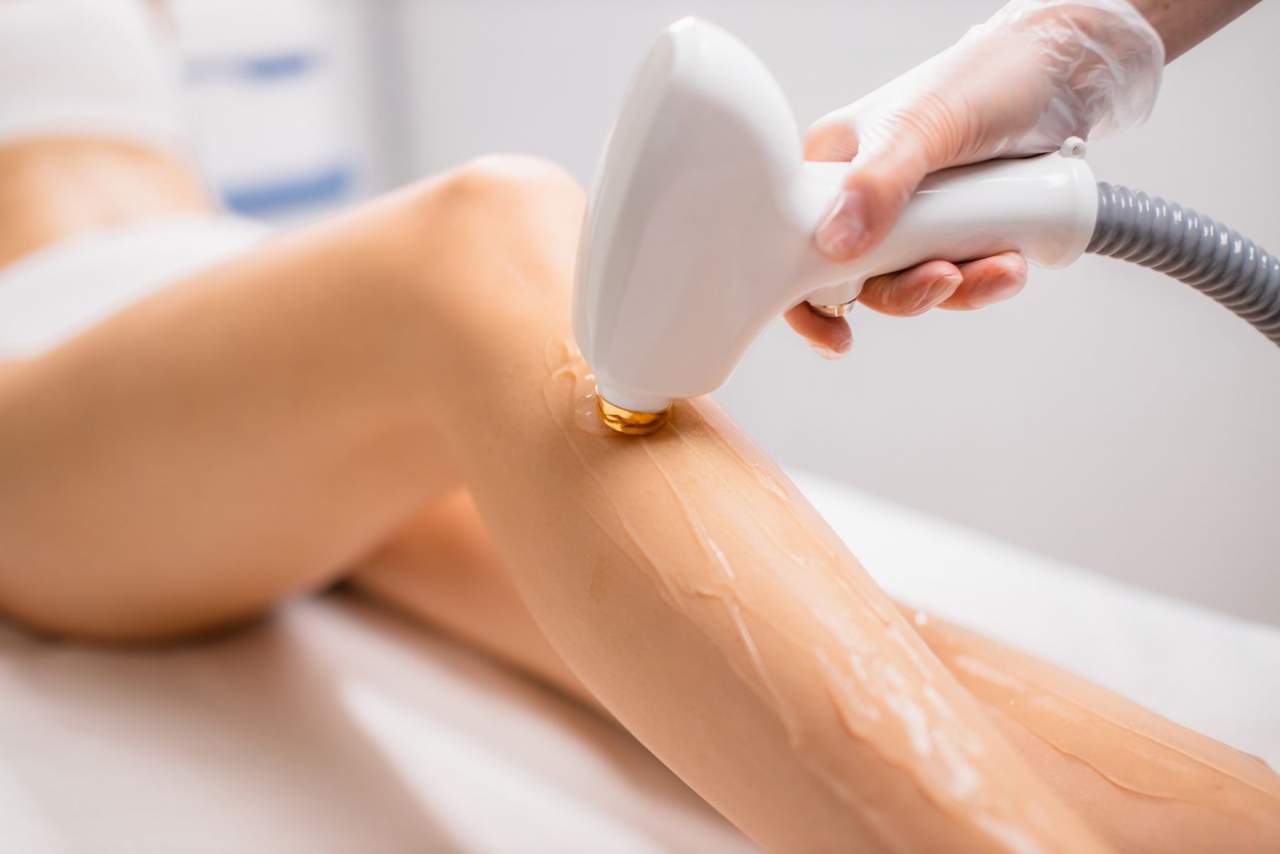 La moda de la depilación láser: Tratamiento en el centro de belleza Ada Beauty