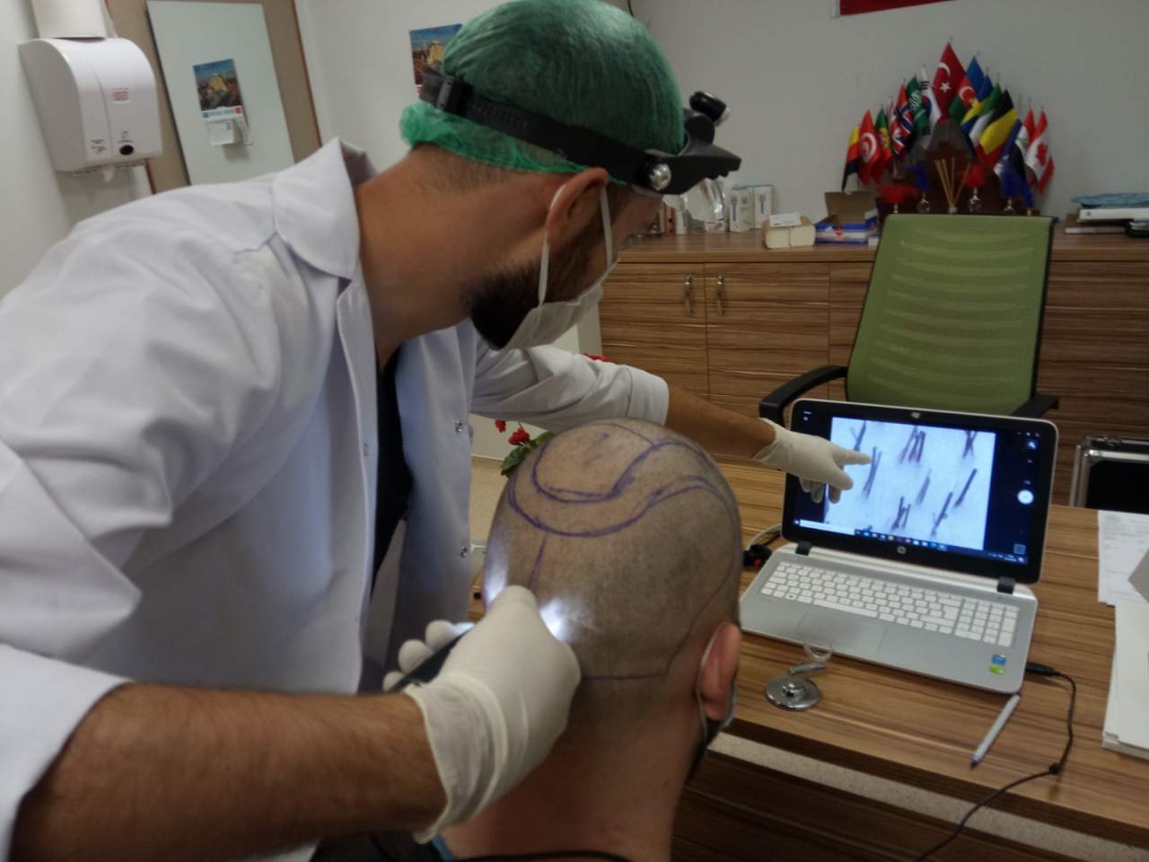 Turismo capilar en Turquía en la reconocida empresa española Fue Hair Transplant System