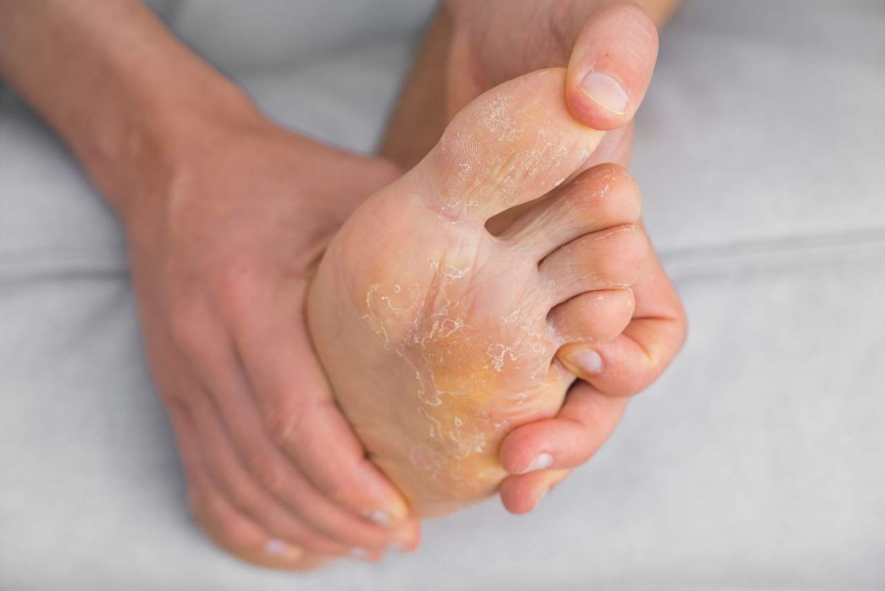 Tejido técnico para curar heridas, la revolución de Parafarmacia Integrativa