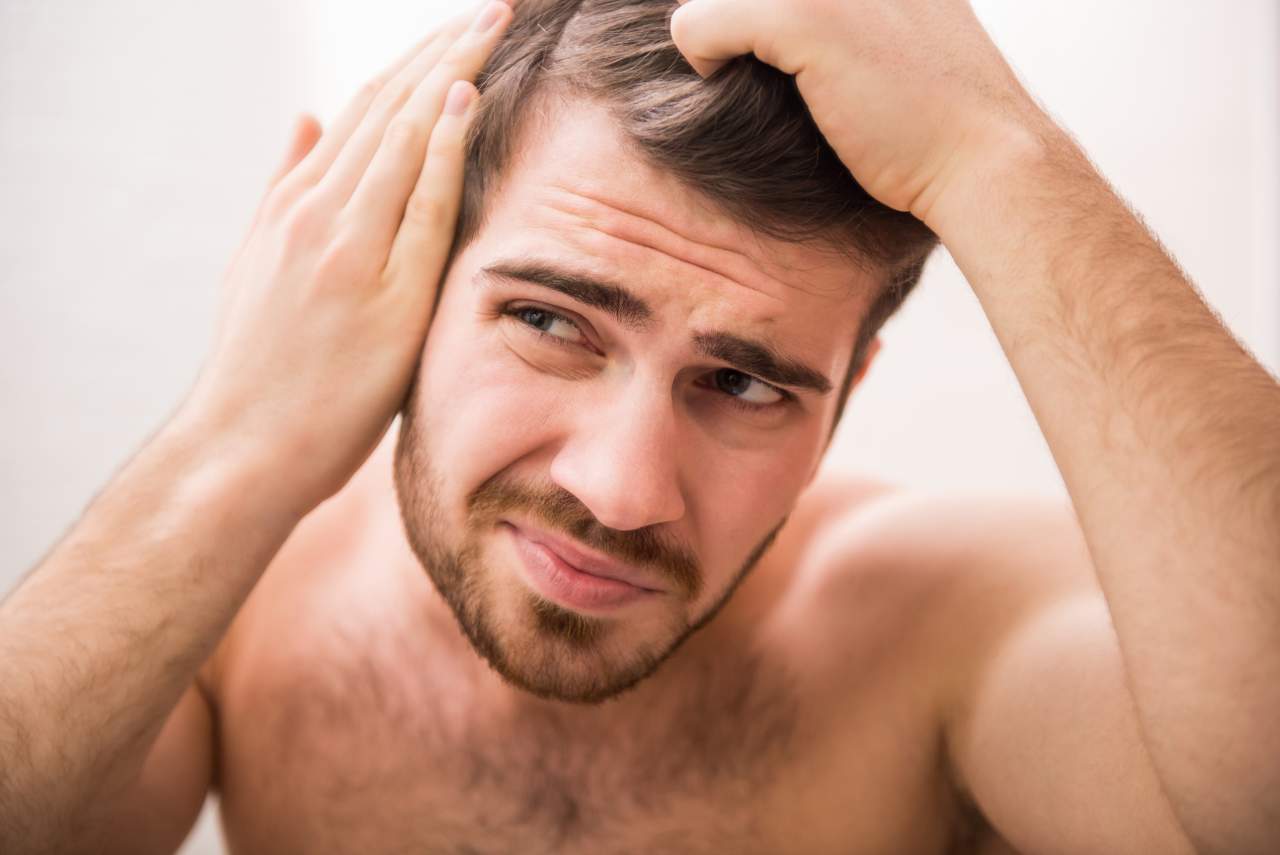 Un 42% de hombres en España son calvos, pero se puede retrasar ese efecto con el método DHI, por Dr. Bern Barbehito