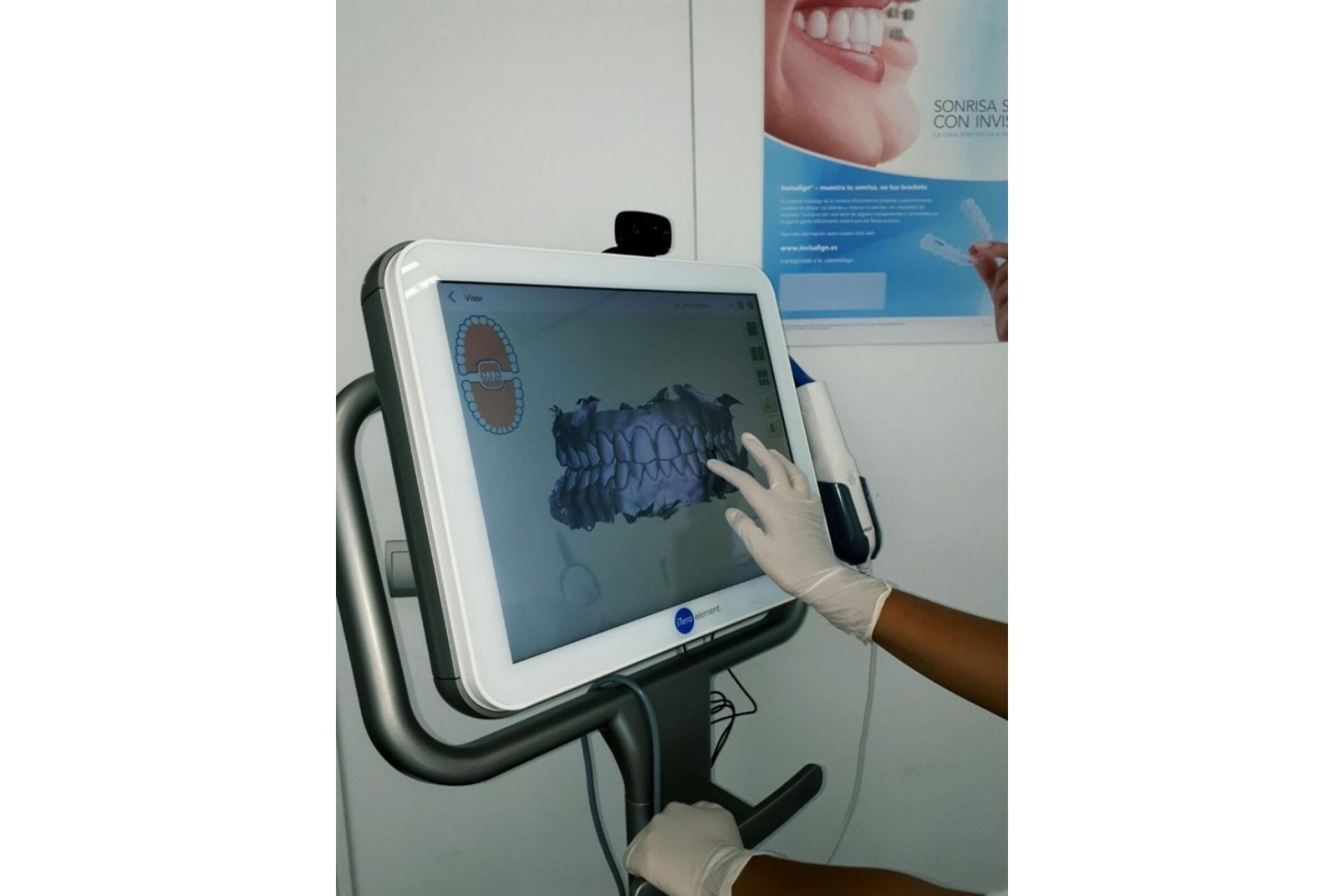 Clínica de Ortodoncia Mariana Sacoto Navia: la única clínica barcelonesa especializada en ortodoncia invisible Invisalign®