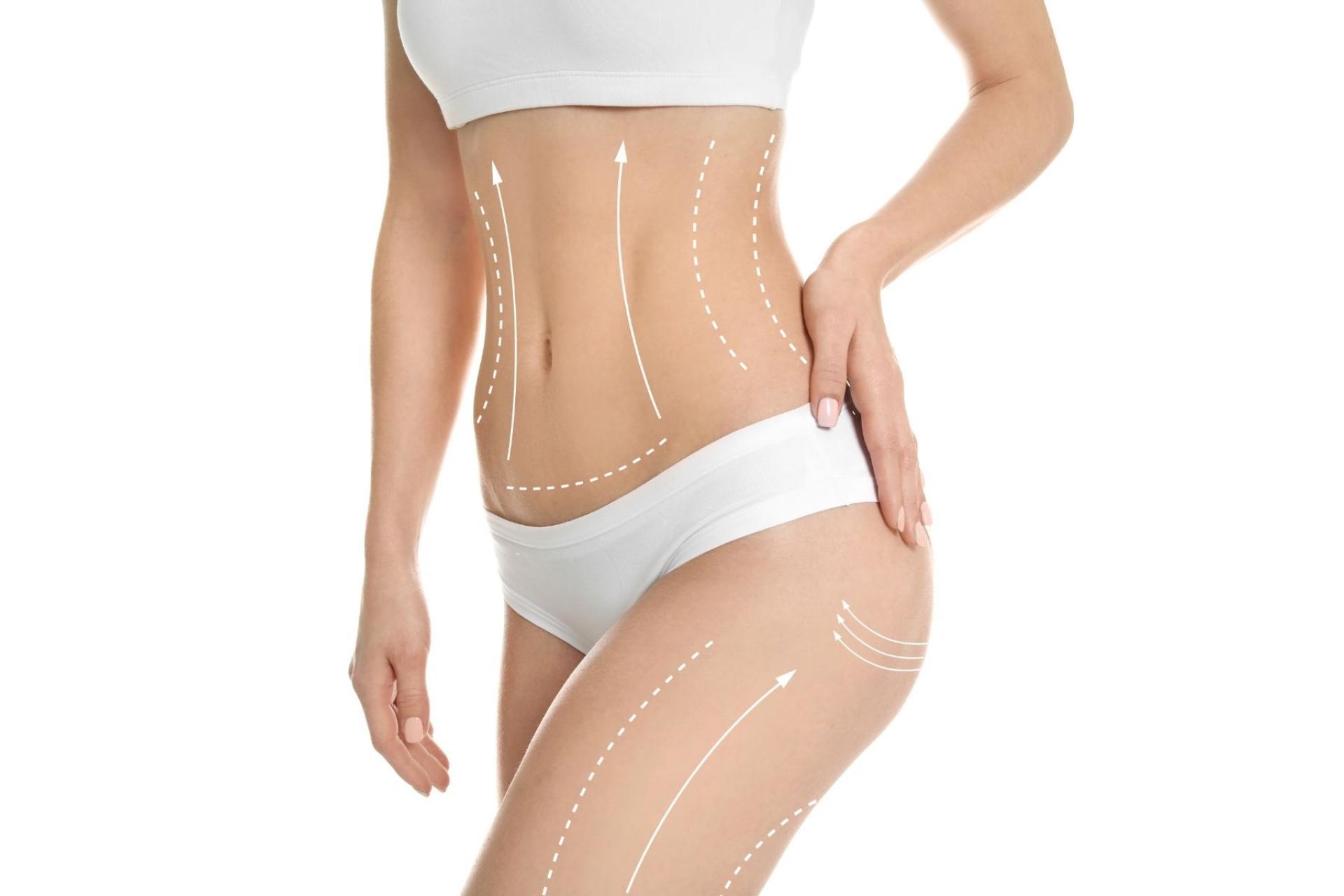 La Clínica Fercasy ofrece el tratamiento corporal TightSculpting