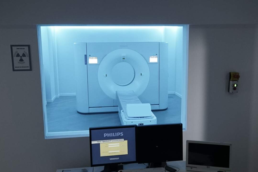 Las patologías cardiovasculares se pueden prevenir gracias al escáner médico de detección espectral