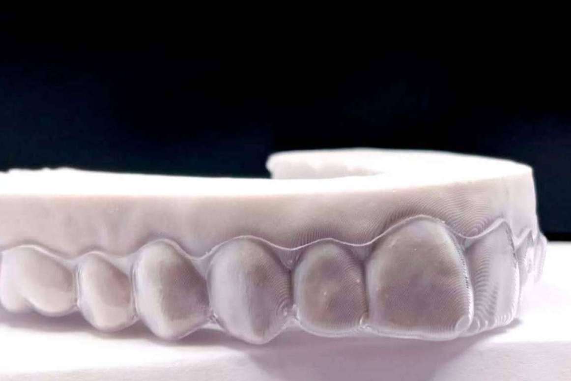 Clínicas Hernadent resuelve las dudas que suelen surgir sobre la ortodoncia invisible