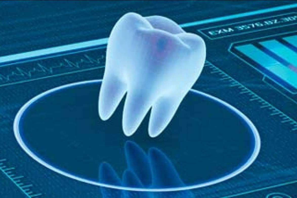 Odontología digital en Clínica Blay Monzó: las técnicas avanzadas en implantología