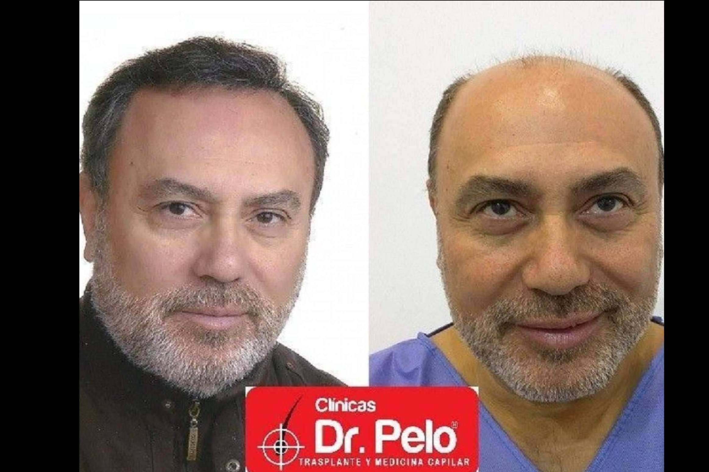 Las Clínicas Dr. Pelo ofrecen todo tipo de tratamientos capilares