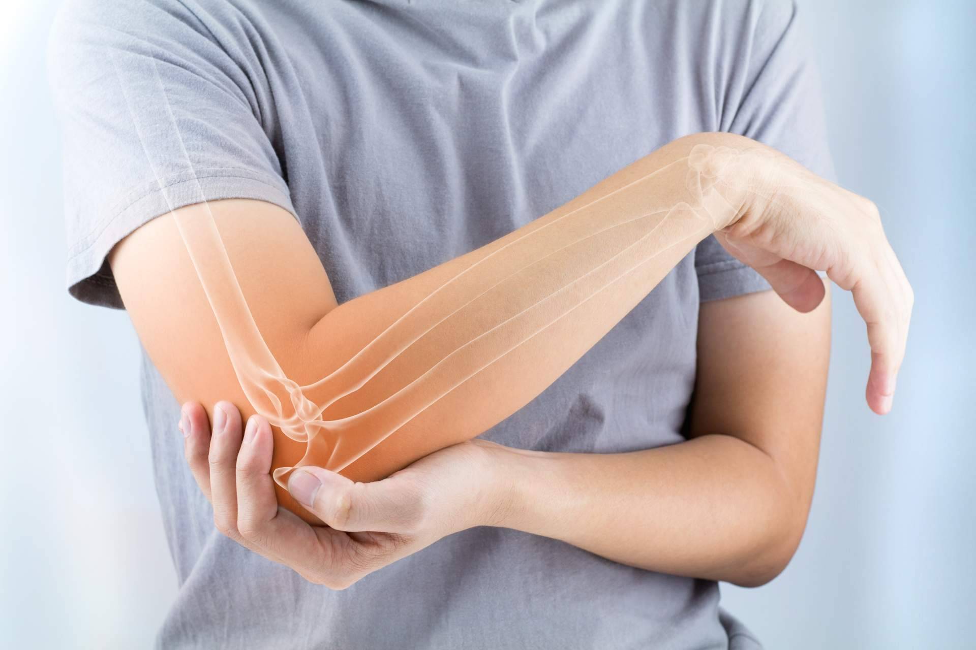 Diet & Life cuenta con los complementos naturales para mejorar la salud de los huesos y articulaciones