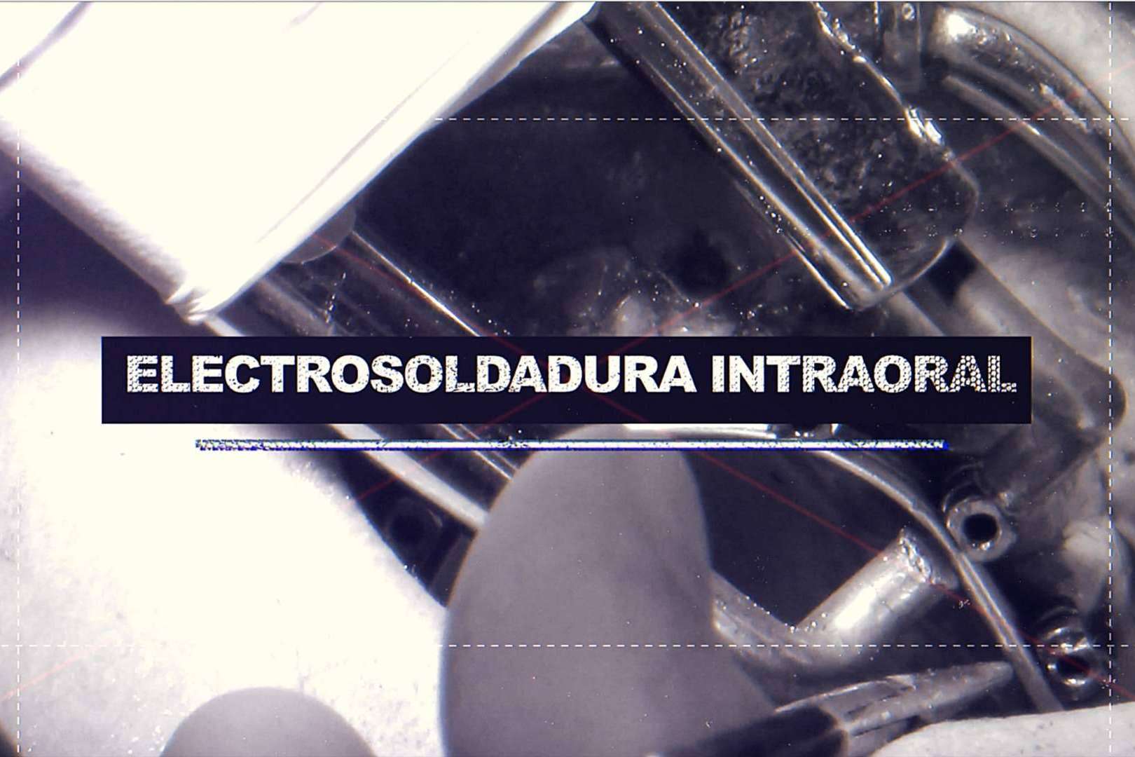 La técnica de implantes con dientes inmediatos del Dr. Ismael Soriano ofrece numerosas ventajas a los pacientes