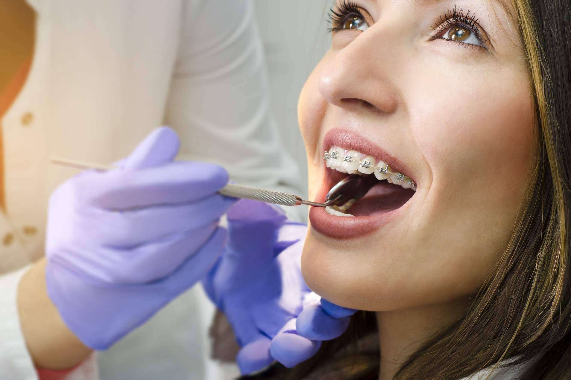 Las ventajas del tratamiento de ortodoncia con brackets, por Helident Clínica Dental