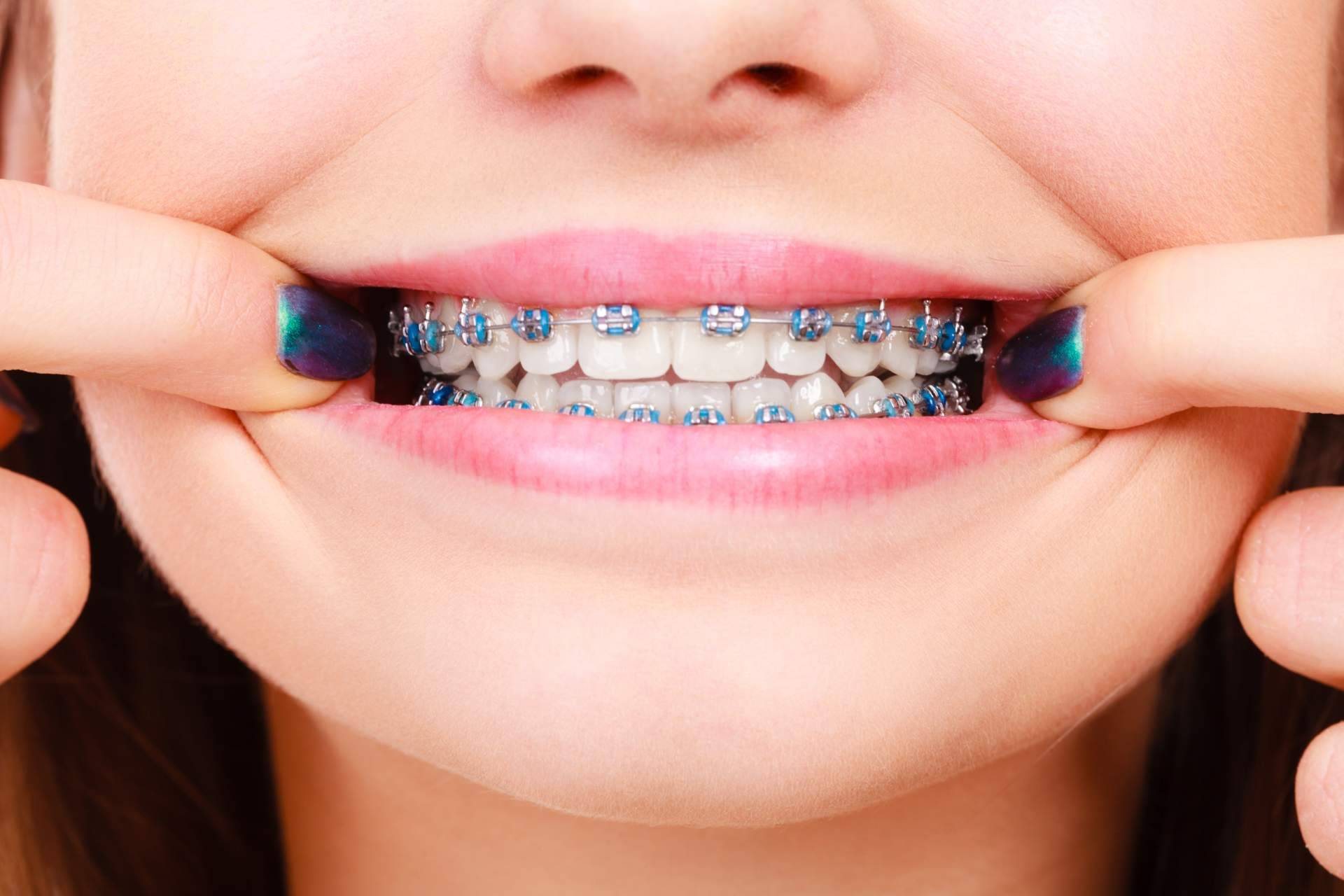 Clínica Sonrisas de Corrales Dental, en Badajoz, cuenta con expertos en tratamientos con ortodoncia de máxima calidad