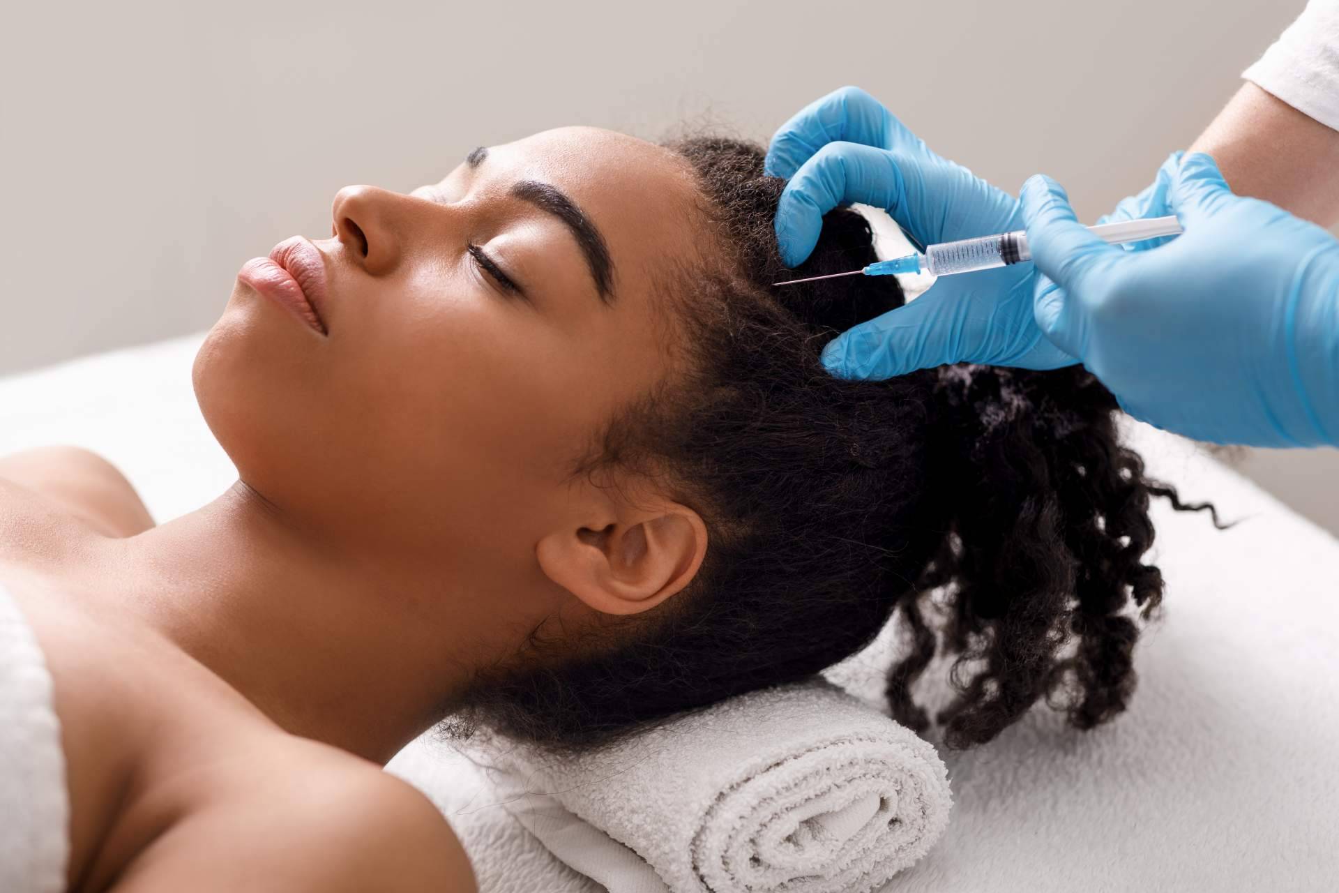 ¿Cuáles son las ventajas de la mesoterapia capilar que realiza el Dr. Bruno Jacobovski?