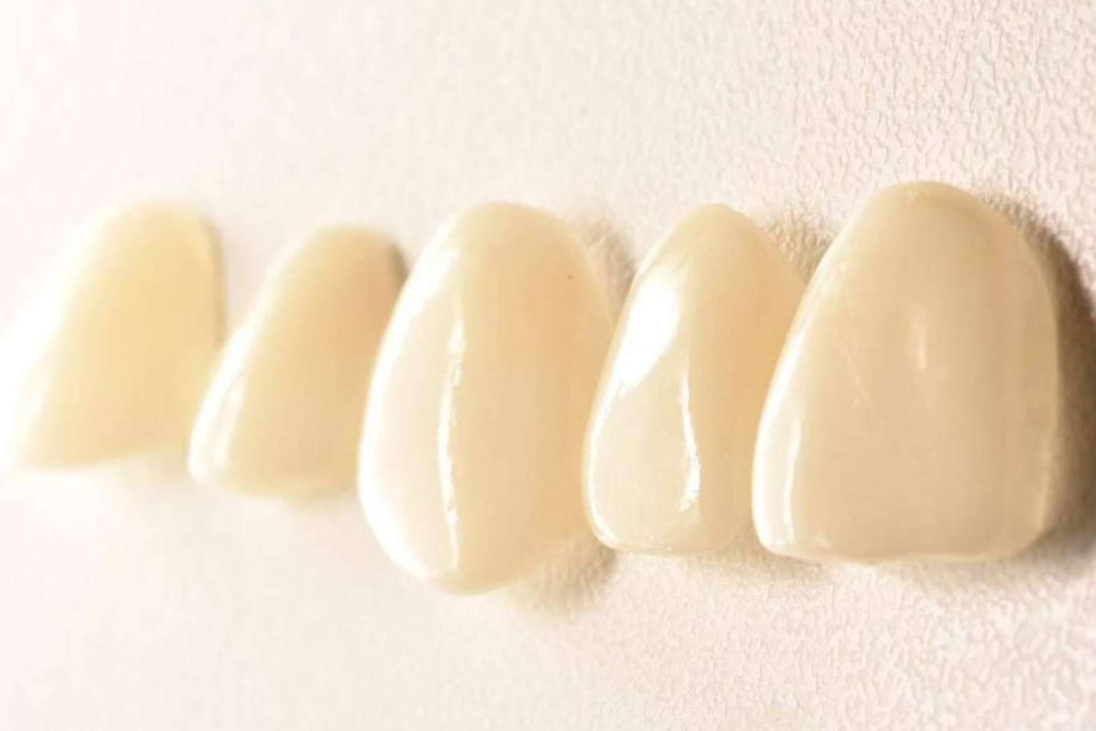¿Cuáles son las ventajas de los tratamientos de estética dental? Implant Clinics