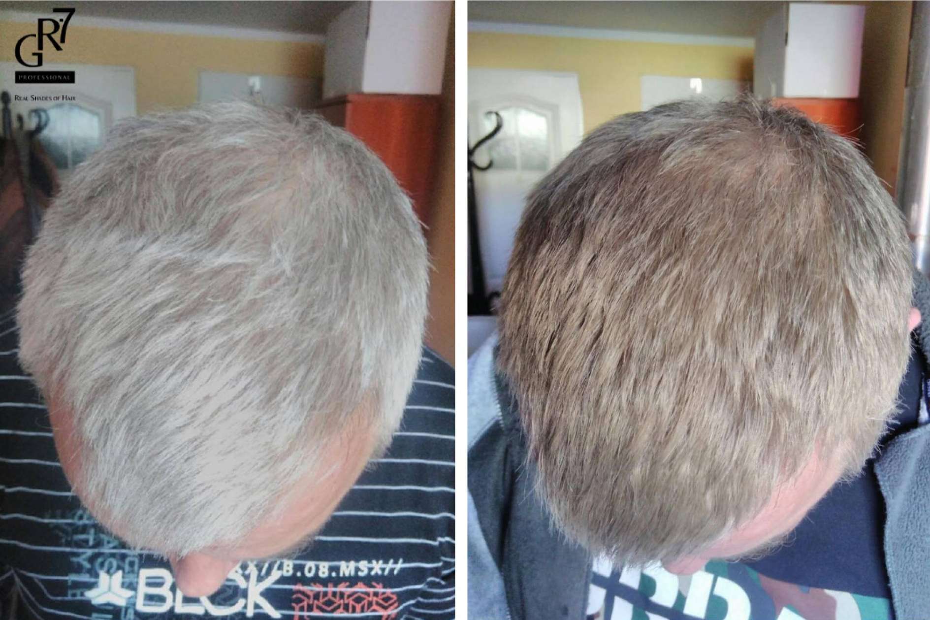 No hay que elegir color para las canas con la loción GR-7