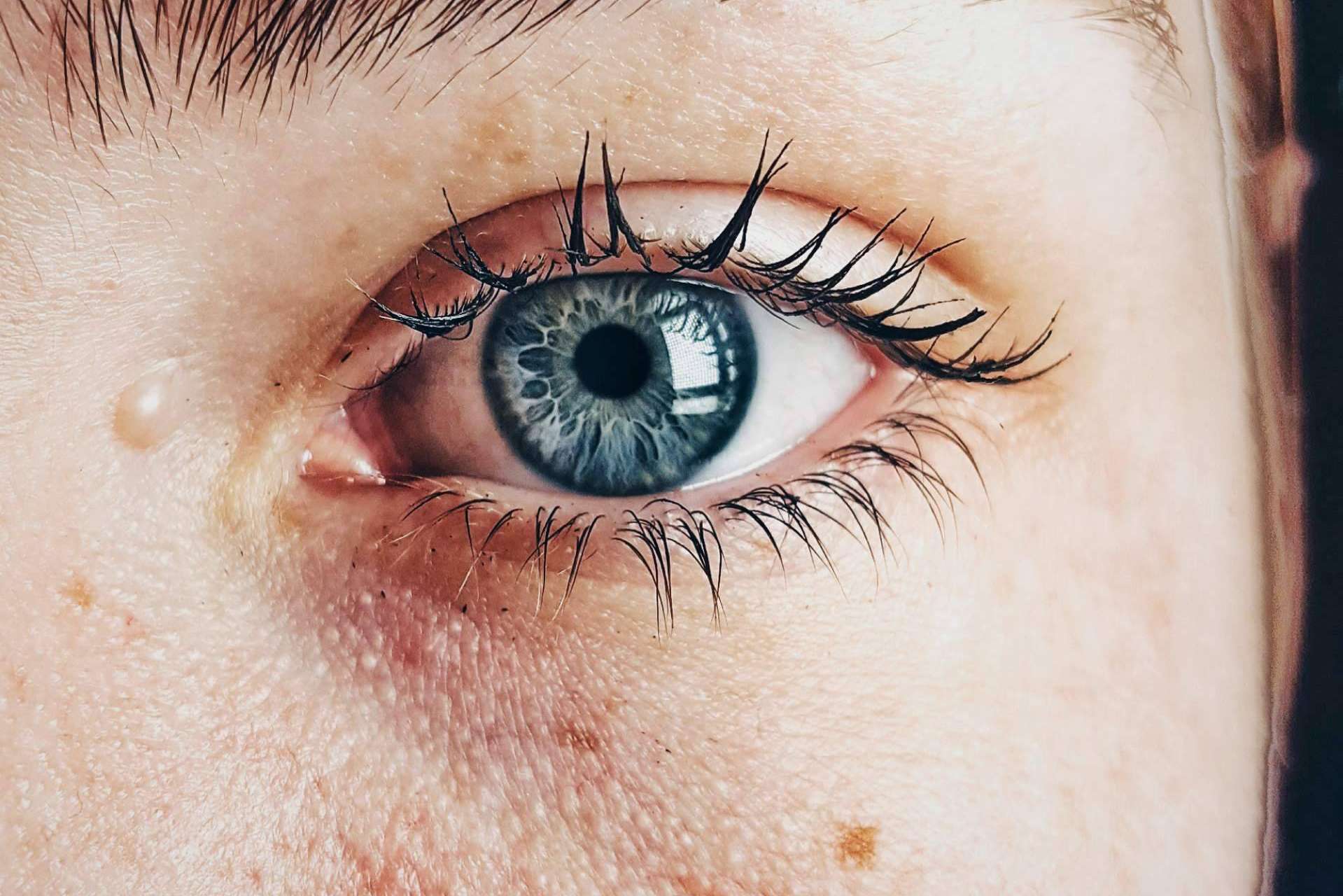 La higiene ocular adecuada evita el síndrome de ojo seco