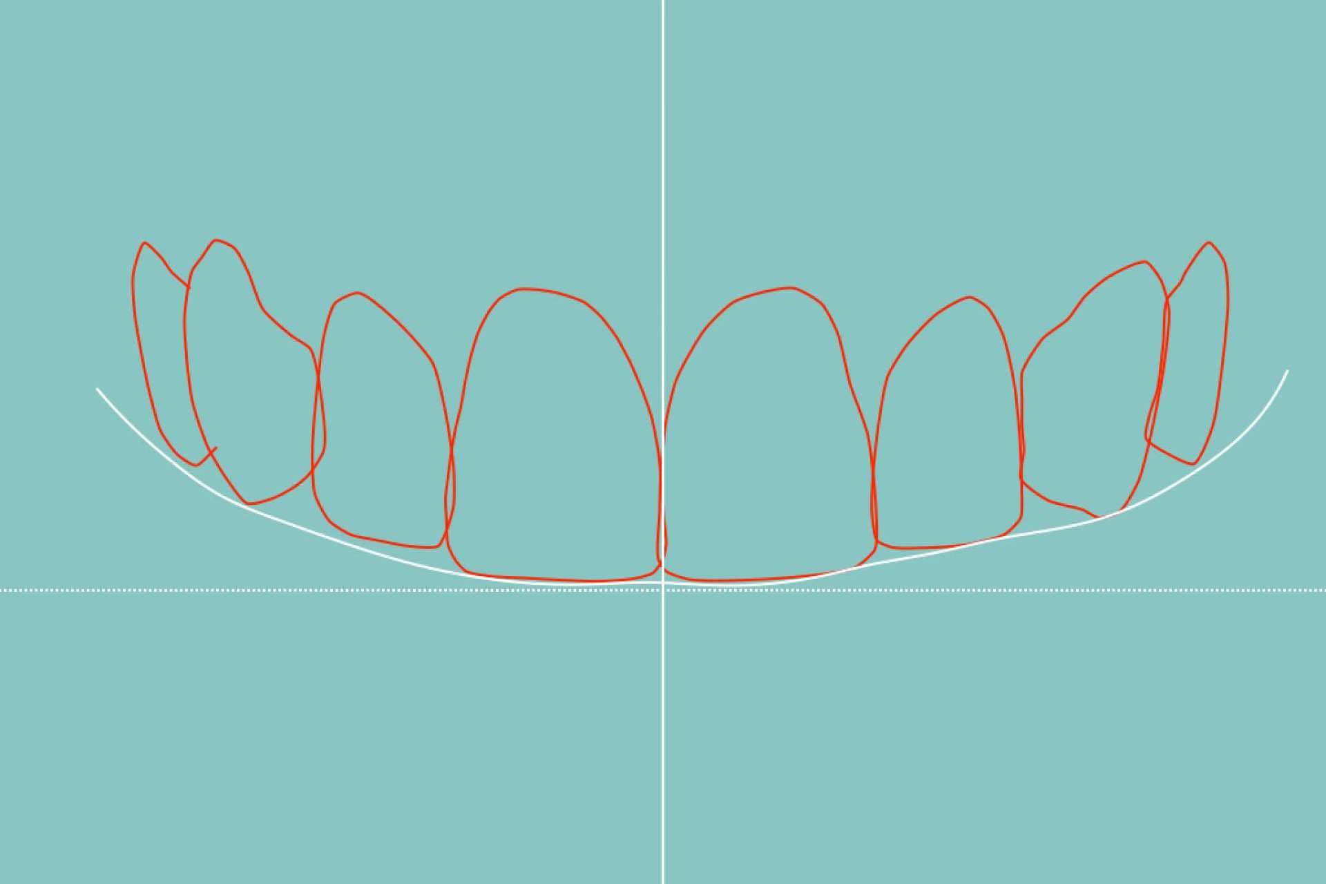 Clínica Dental Blay + Monzó dispone de tecnología de vanguardia para el diseño de sonrisa