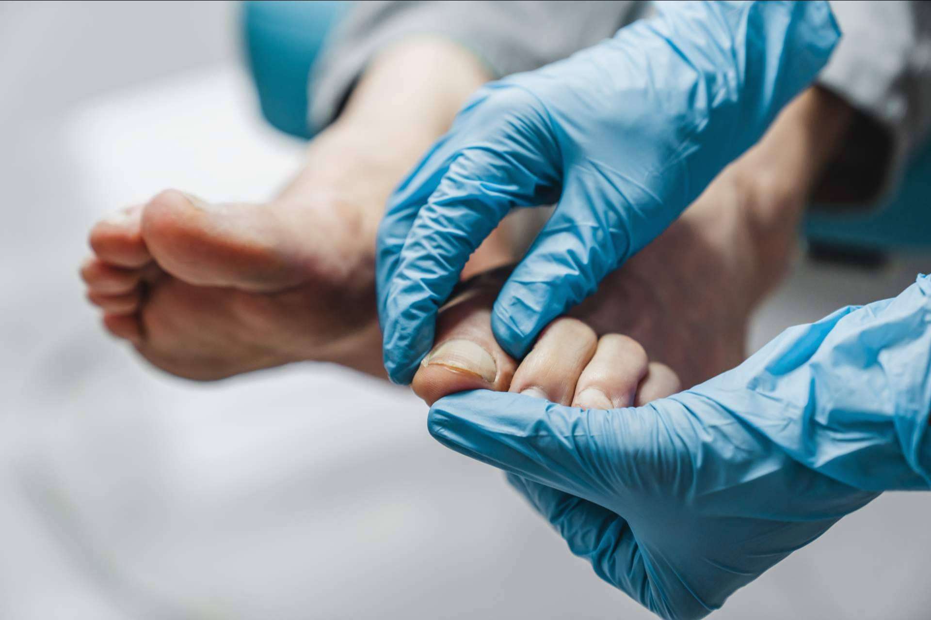 Tratar las afecciones de los pies a tiempo mediante la quiropodia con los expertos de podología de Clínica Viasalud