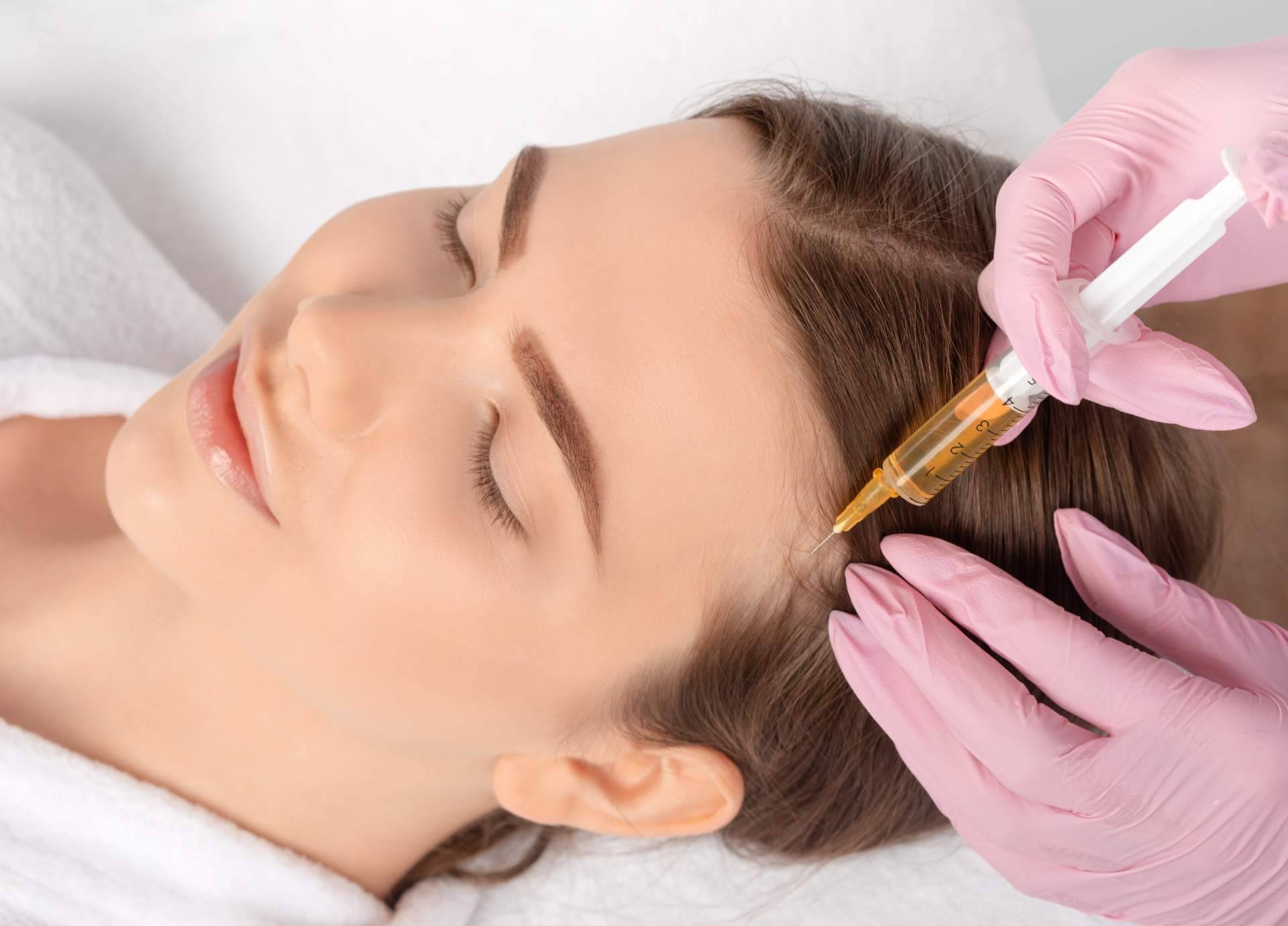 Vitaminas, mesoterapia capilar y plasma rico en plaquetas