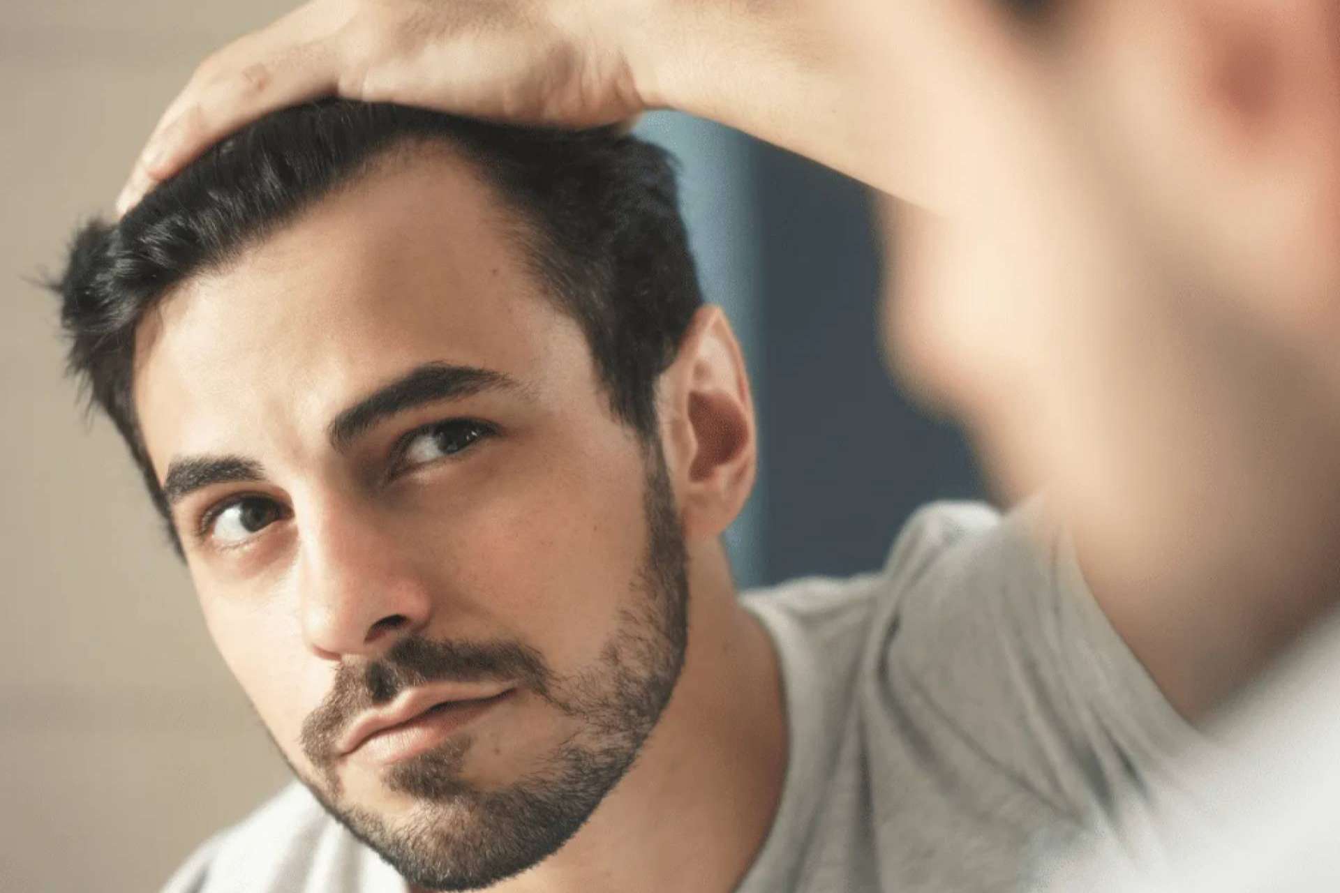 Microinjerto capilar en Madrid de la mano del Dr. Antonio Fernández Brito en Microcapilar Hair Clinic