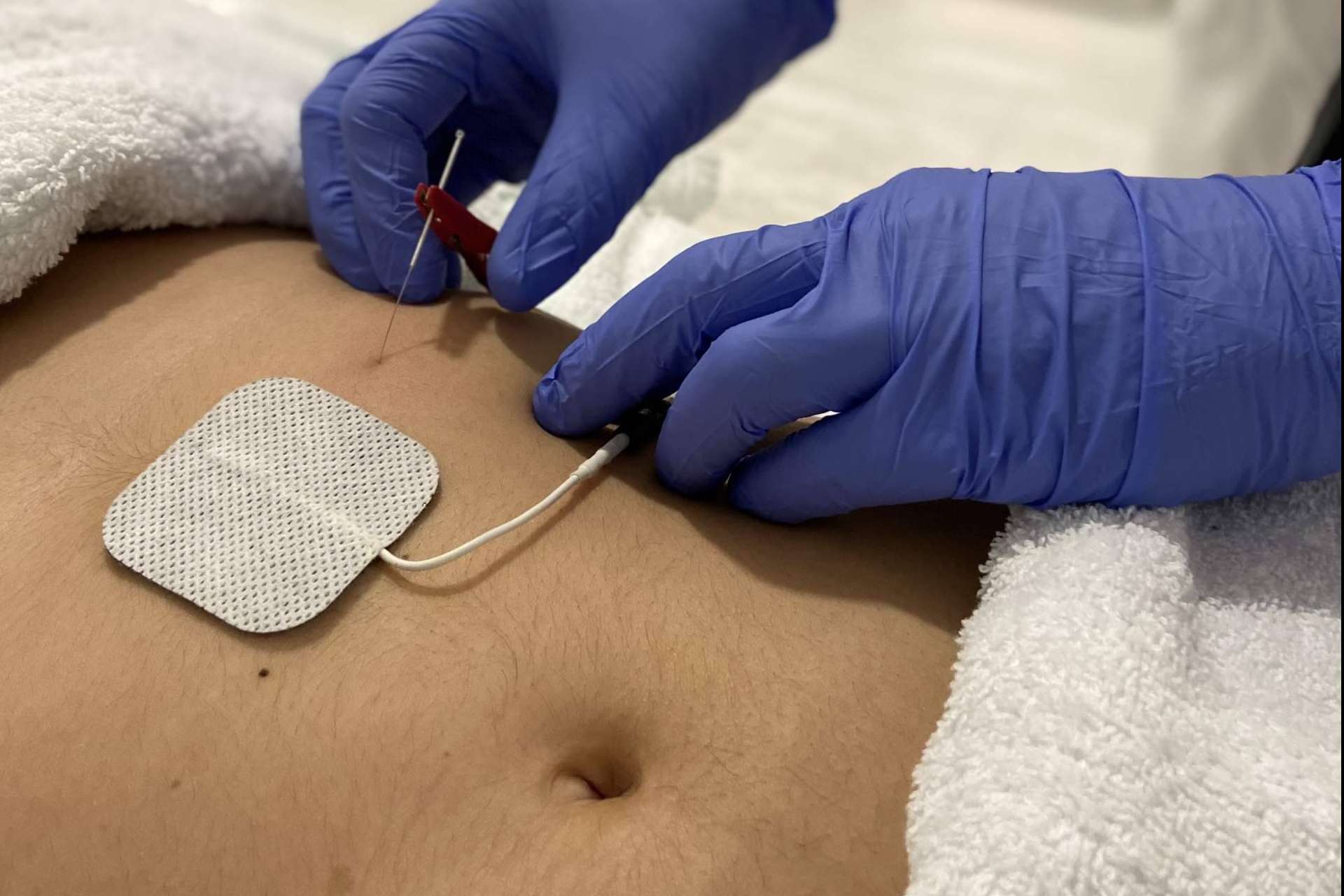 Neuroline T6 ayuda a perder 10 kg en dos meses sin sensación de hambre