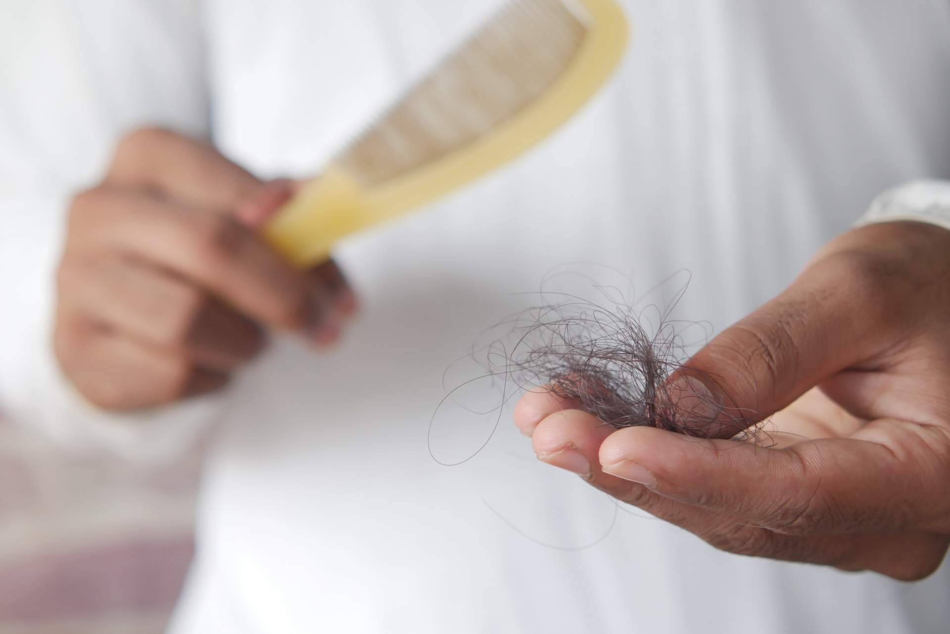 El aumento de enfermedades autoinmunes que provocan la caída del cabello