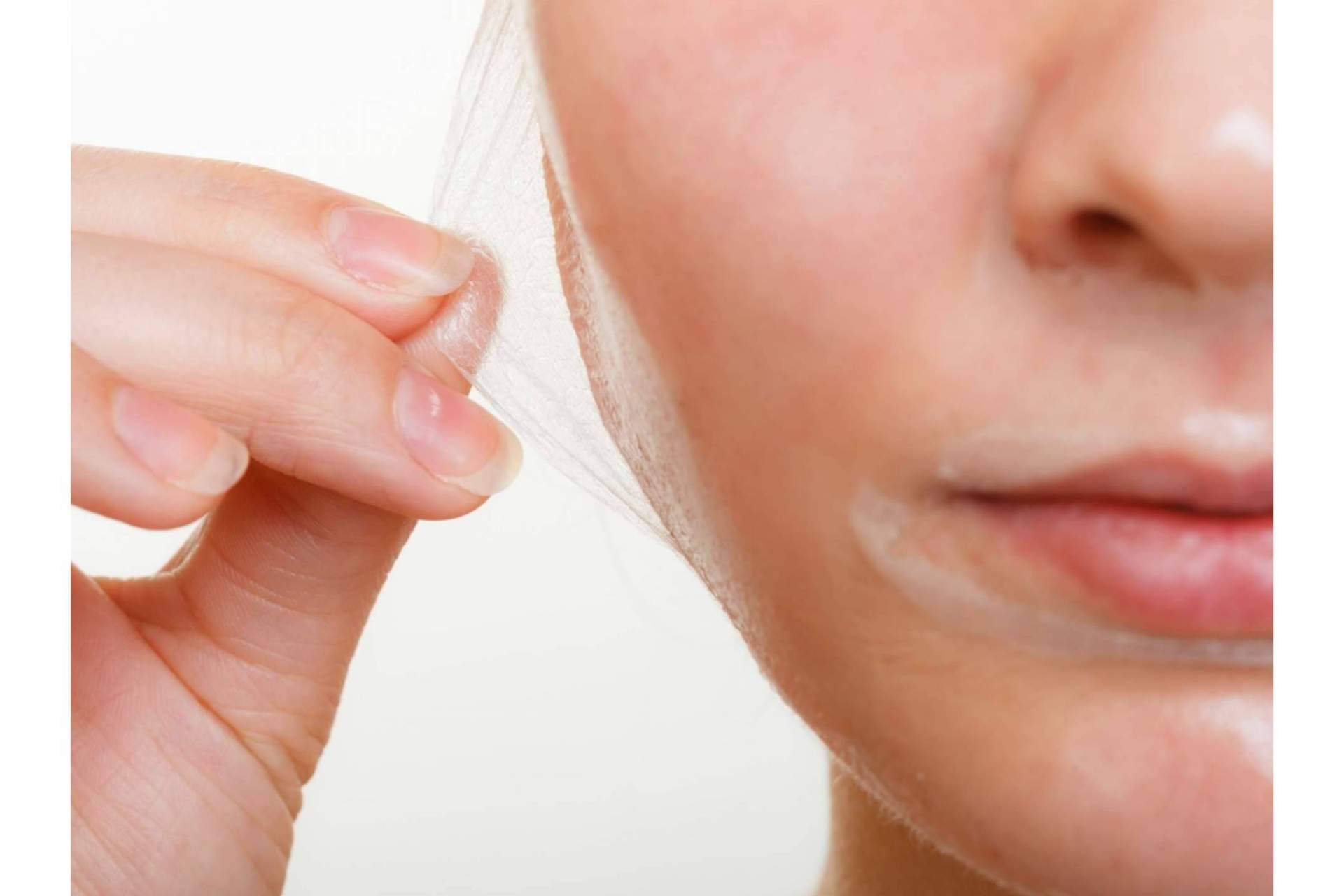 Tratamientos de peeling químico en diferentes partes del cuerpo, en Crina Rus Beauty Center