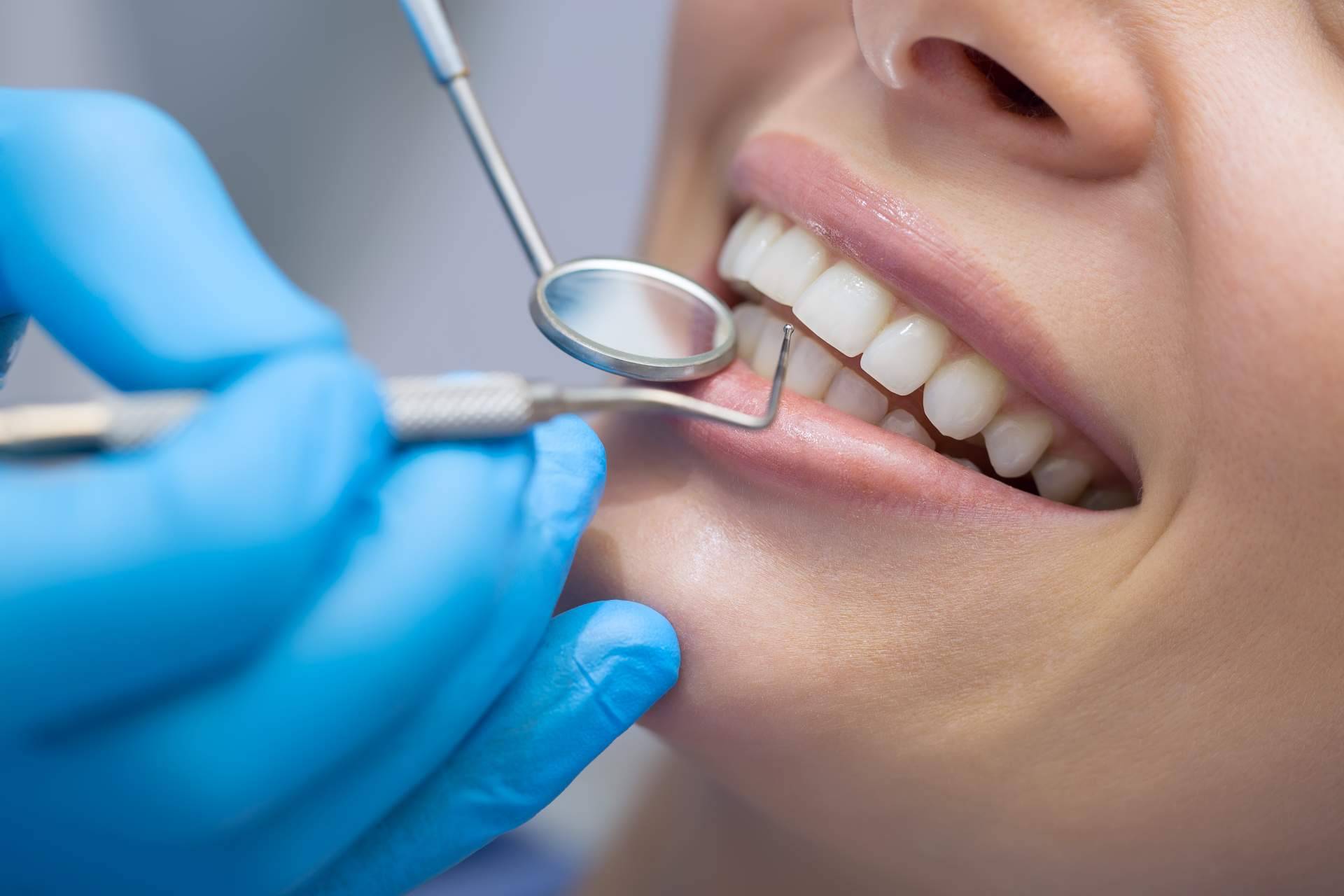 ¿Cuándo es necesaria la cirugía ortognática en un diagnóstico de sonrisa gingival?