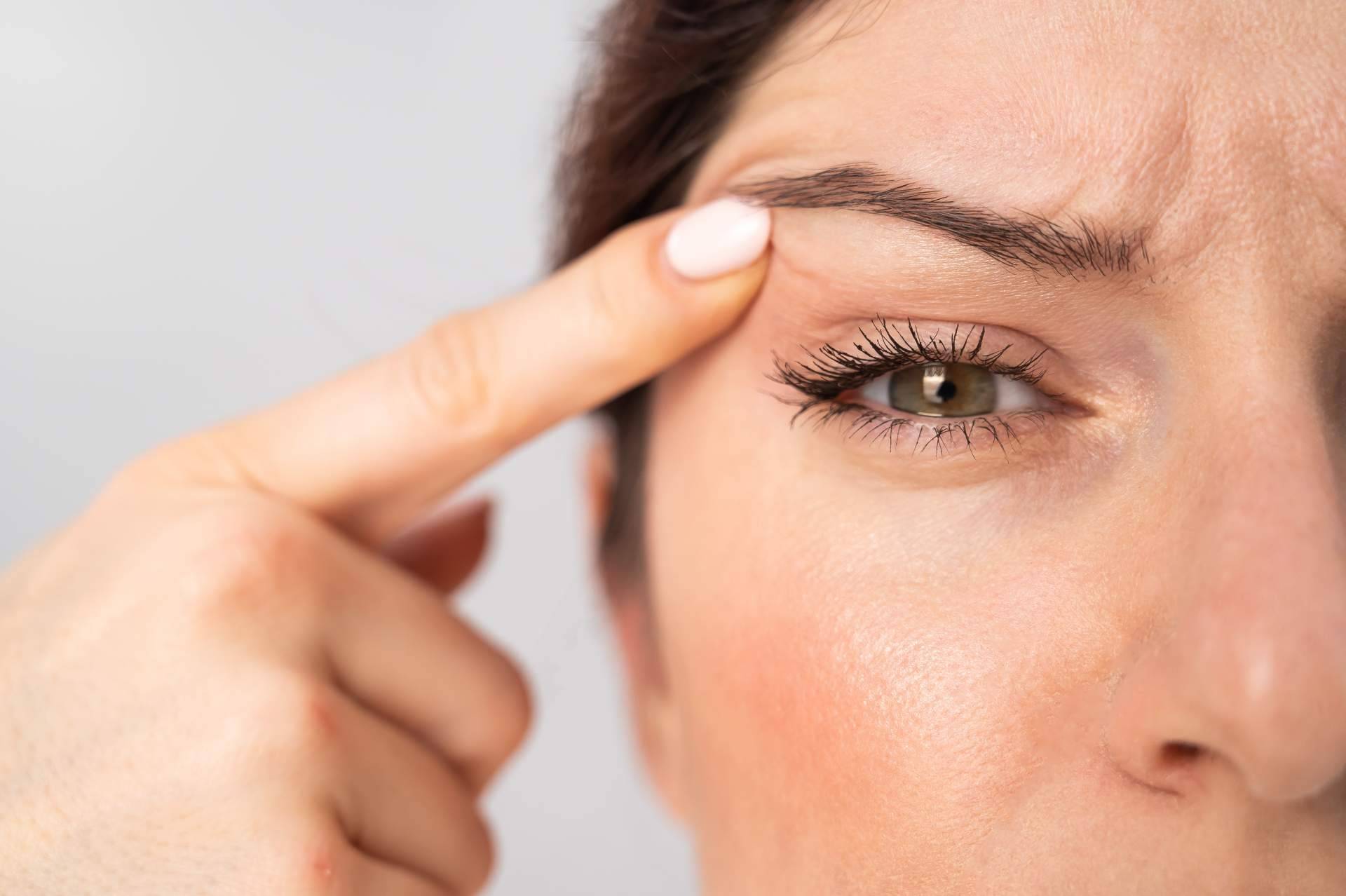 Alluring Clinic y la blefaroplastia no quirúrgica