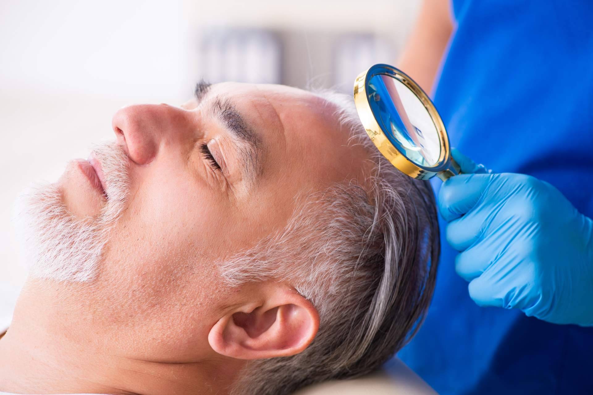 Clínicas Élite Capilar, expertos en el implante de pelo