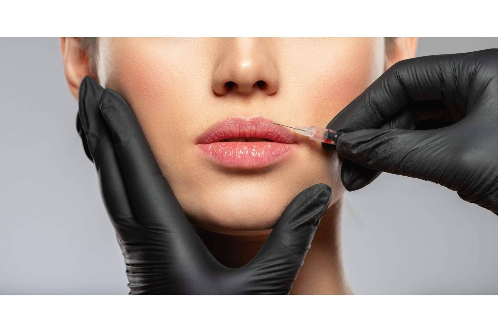 Aumento de labios y bótox, el pack más solicitado en 360Clincis