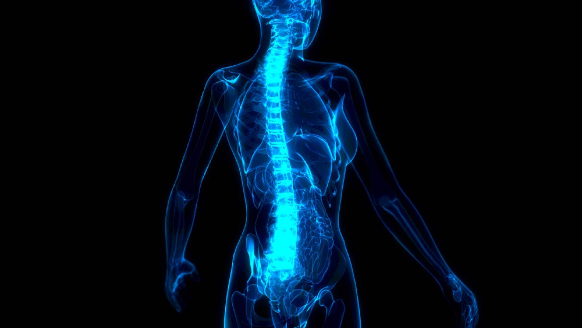 ¿Cómo funciona la rizólisis por radiofrecuencia para tratar el dolor lumbar y cervical?