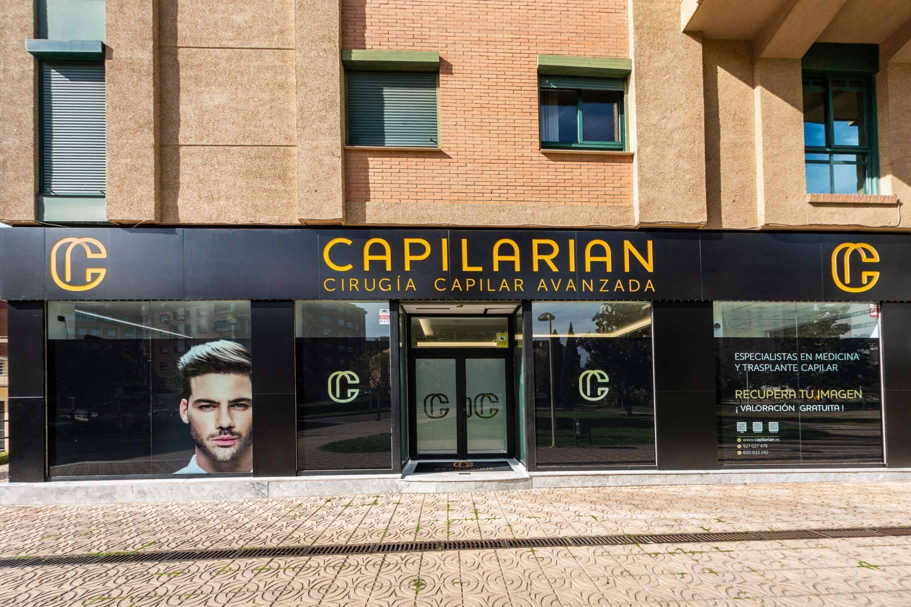 Recuperación del pelo con el cabello propio, con Capilarian
