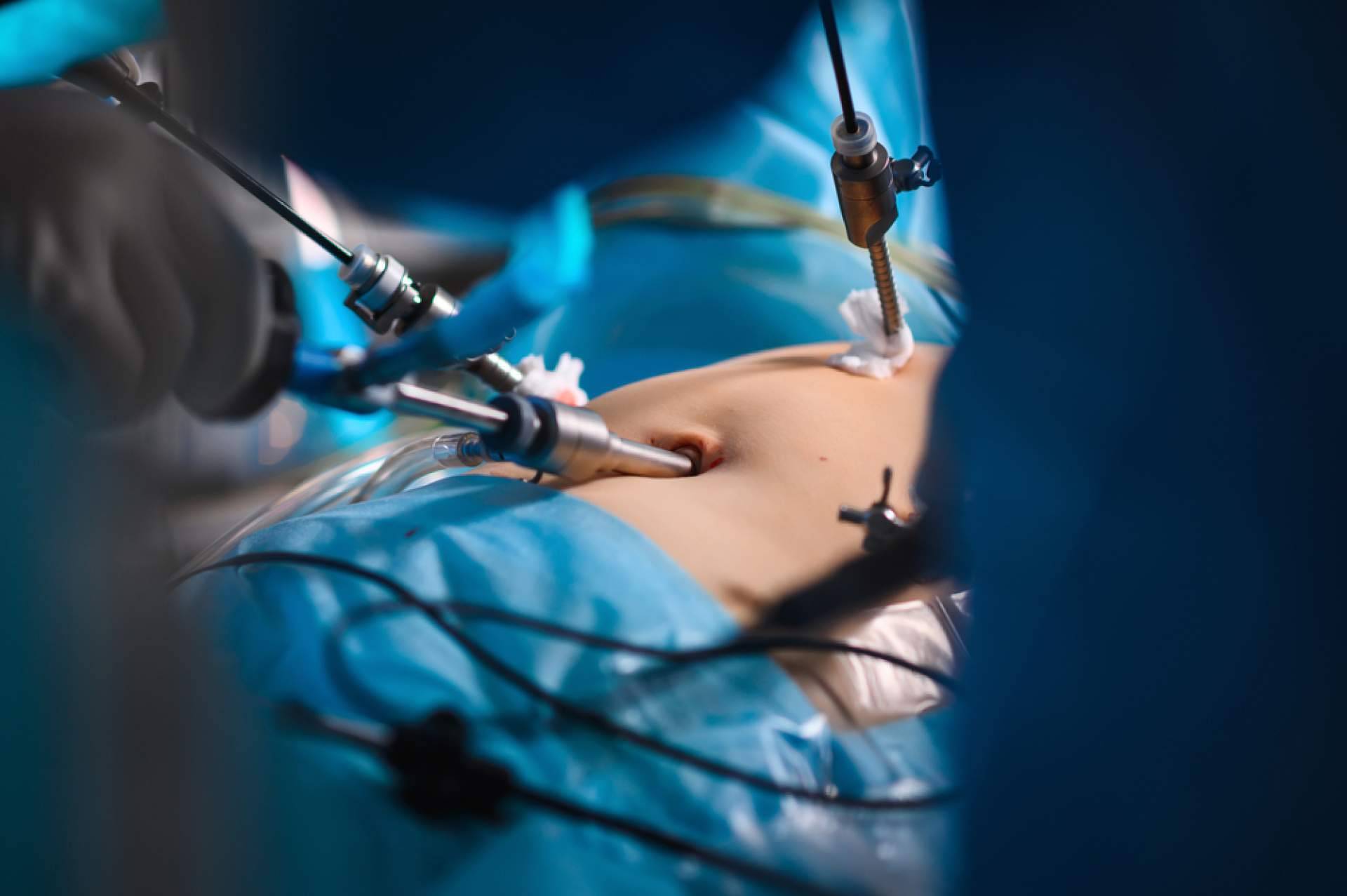 El Dr. Javier Martínez Pascuas resuelve algunas dudas sobre la cirugía de hernia inguinal