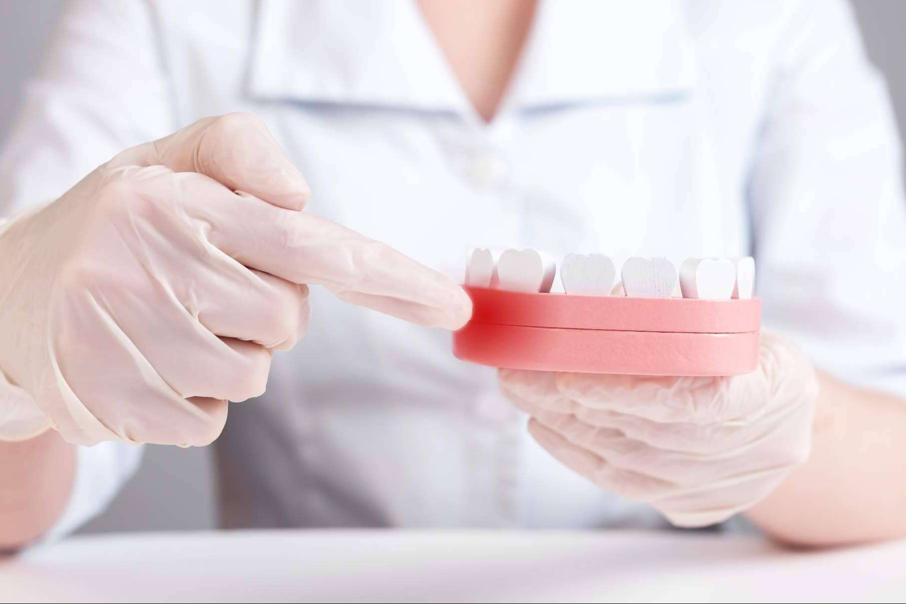 Odontólogos especializados llevan a cabo tratamientos de periodoncia en Clínica Dental Delgado