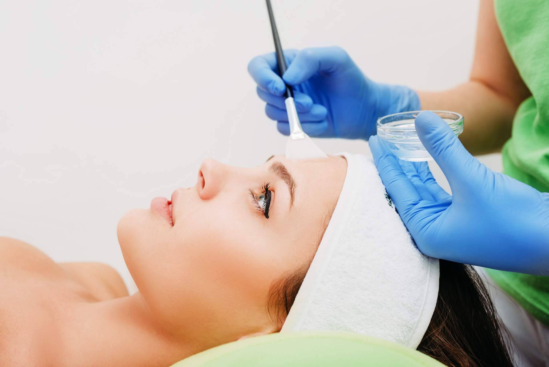 Lograr una piel radiante mediante el peeling efecto terapéutico y rejuvenecedor que ofrece Vitaliderma Skindiet