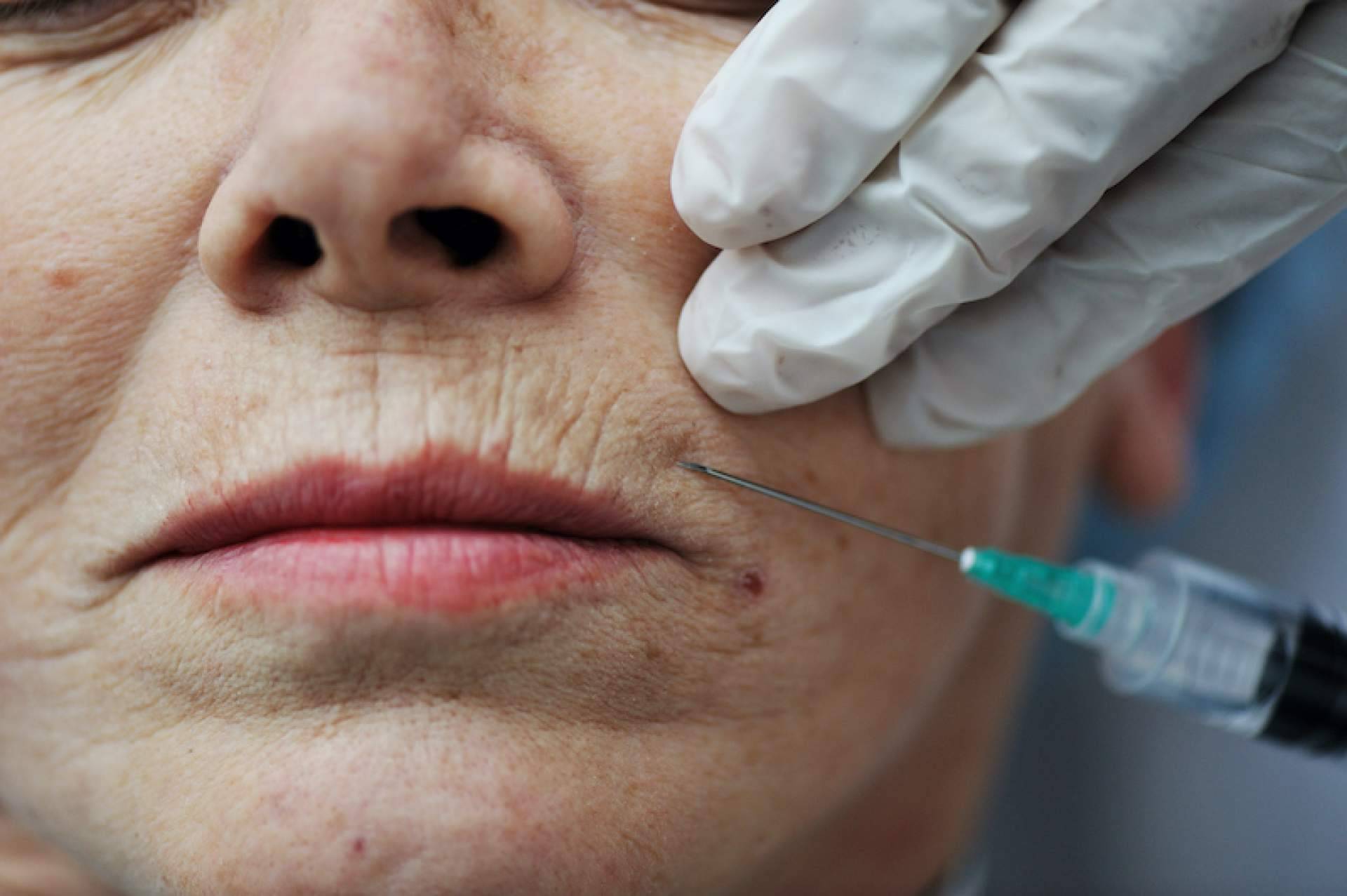 ¿De qué trata la cirugía maxilofacial?, con Maisonnave Urban Human Clinic