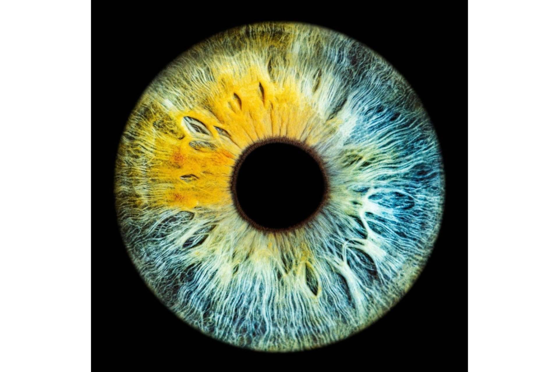 Celebridades con heterocromía ocular, de la mano de Clínica Eyecos