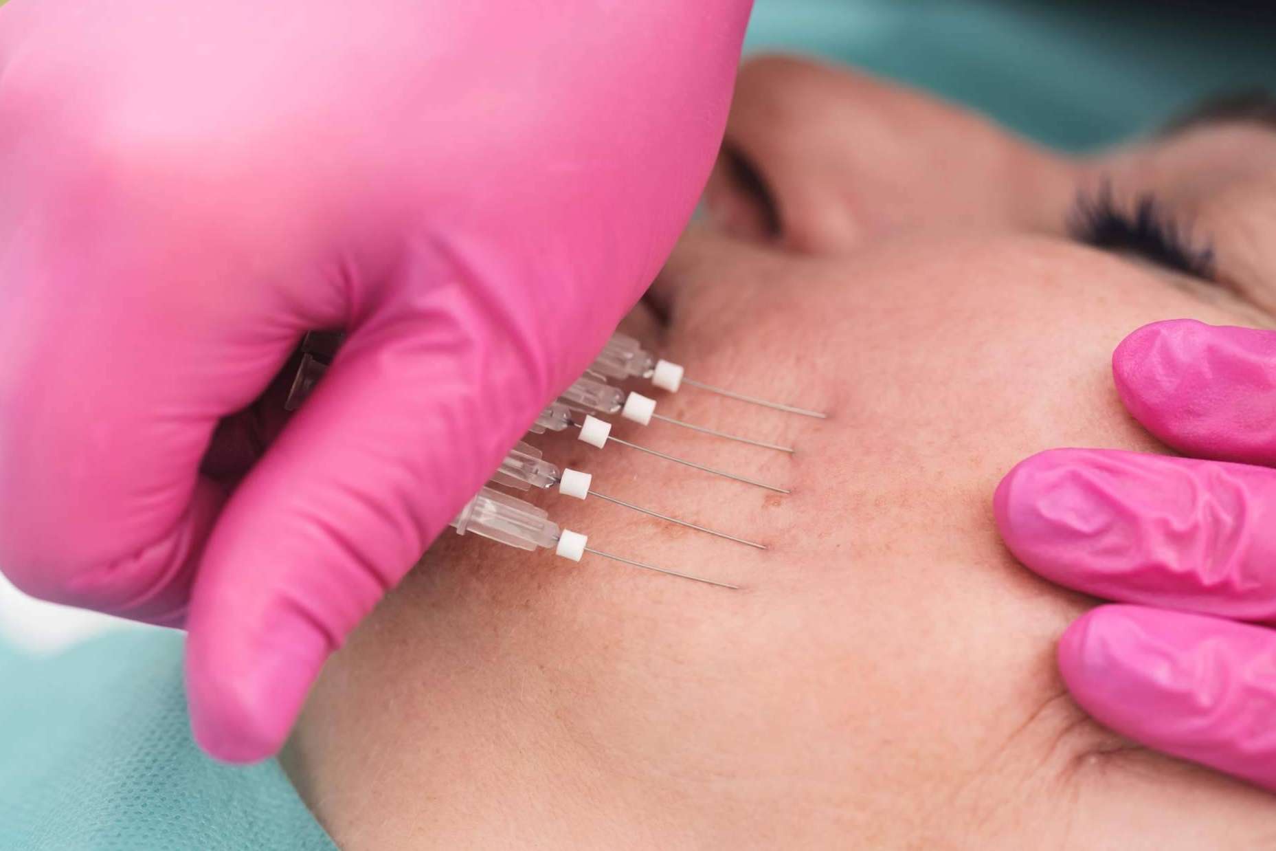 Dermasthetic ofrece cursos de especialización para médicos que se dedican a la estética