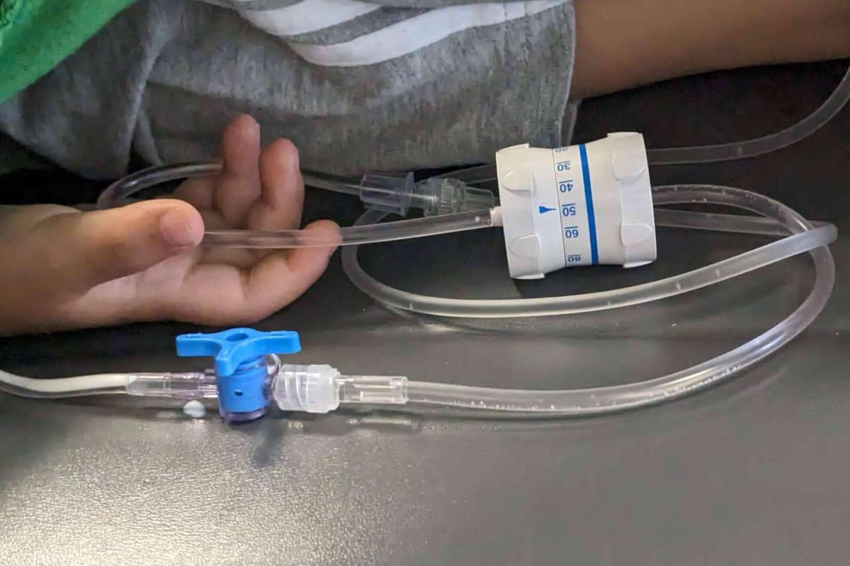 Clínica Dental Ulman, la sedación consciente para una experiencia sin miedo al dentista
