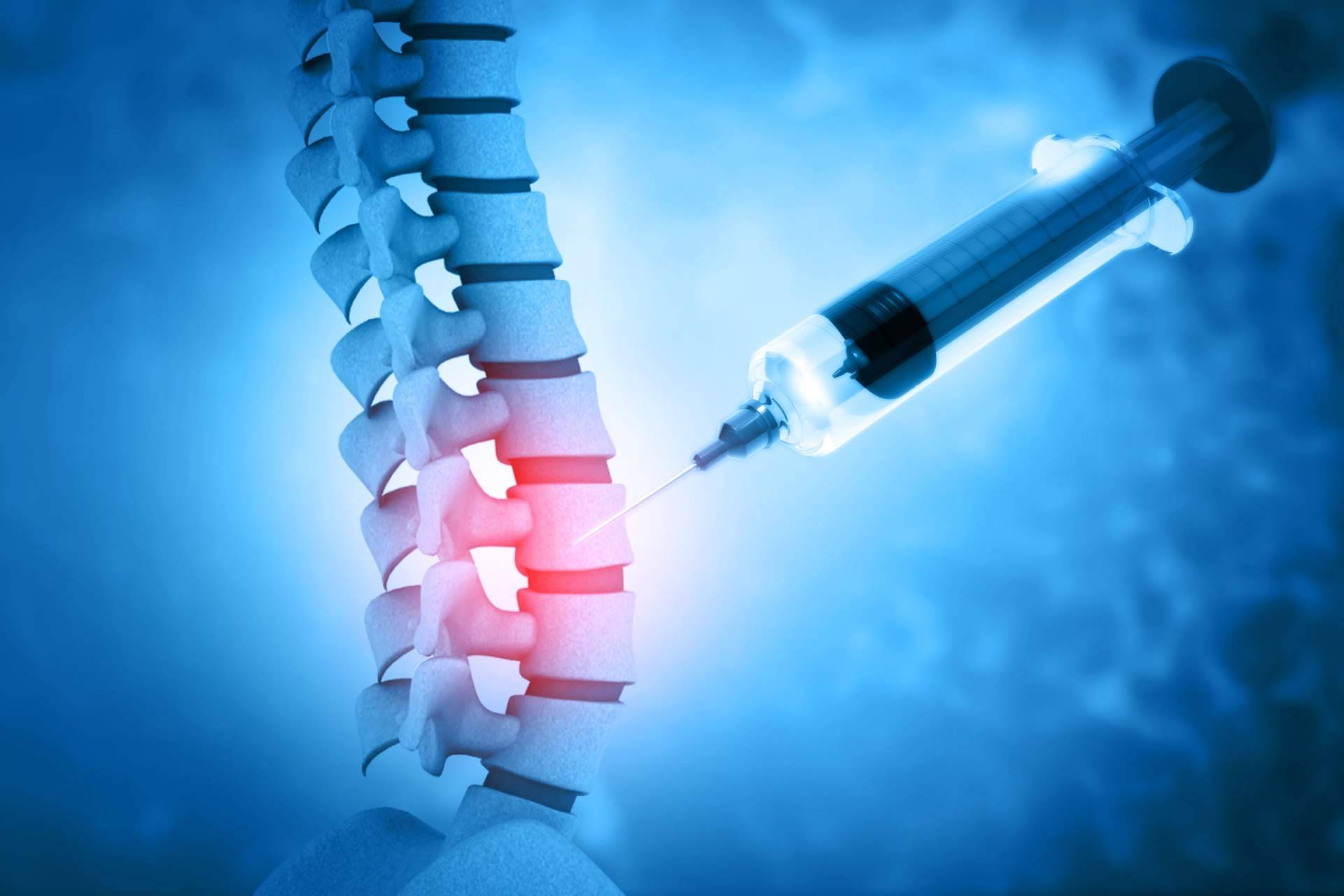 La Unidad de Columna y Traumatología de Biziondo sobre el tratamiento de ozonoterapia