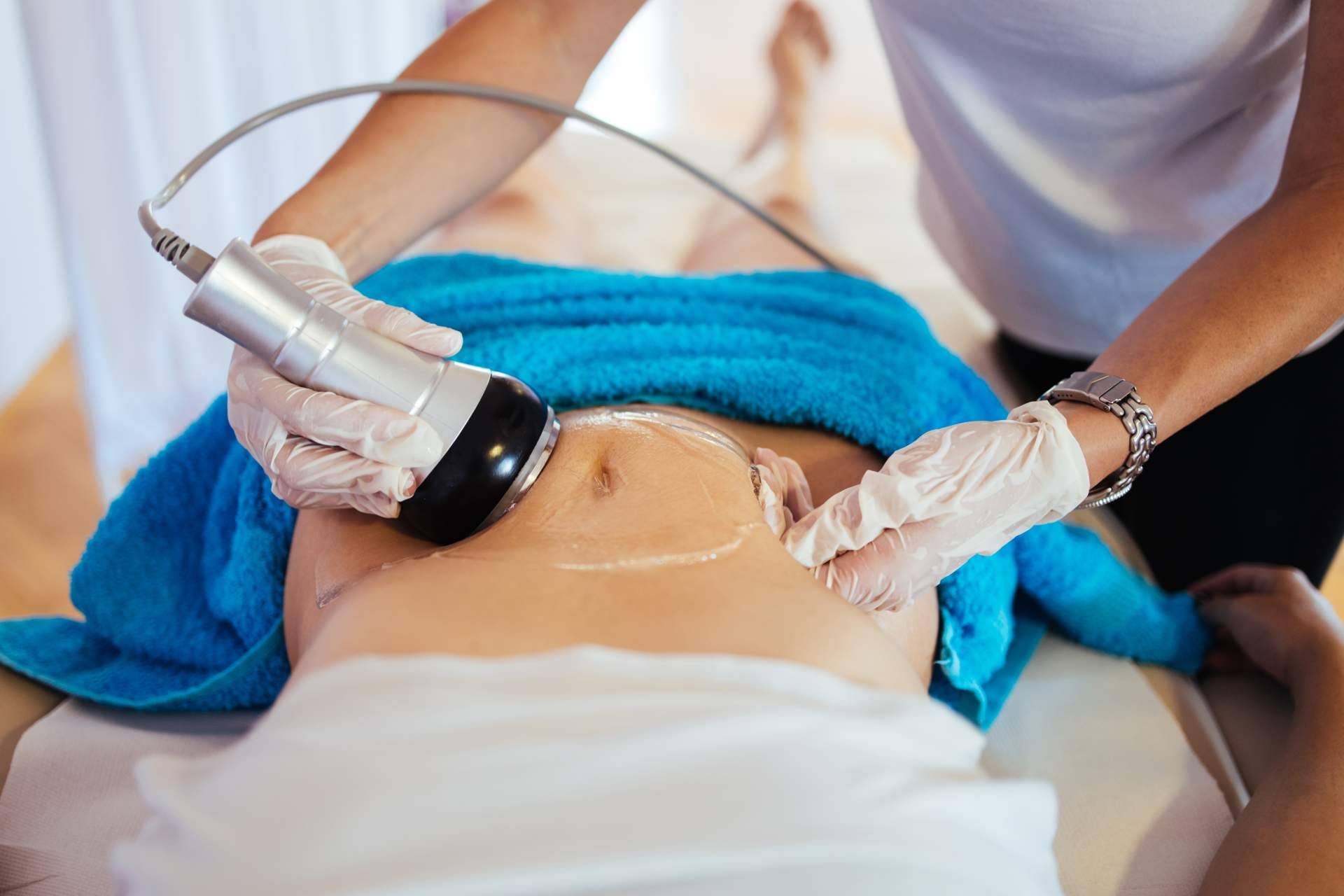 Centro Médico El Pilar sobre el tratamiento de radiofrecuencia corporal