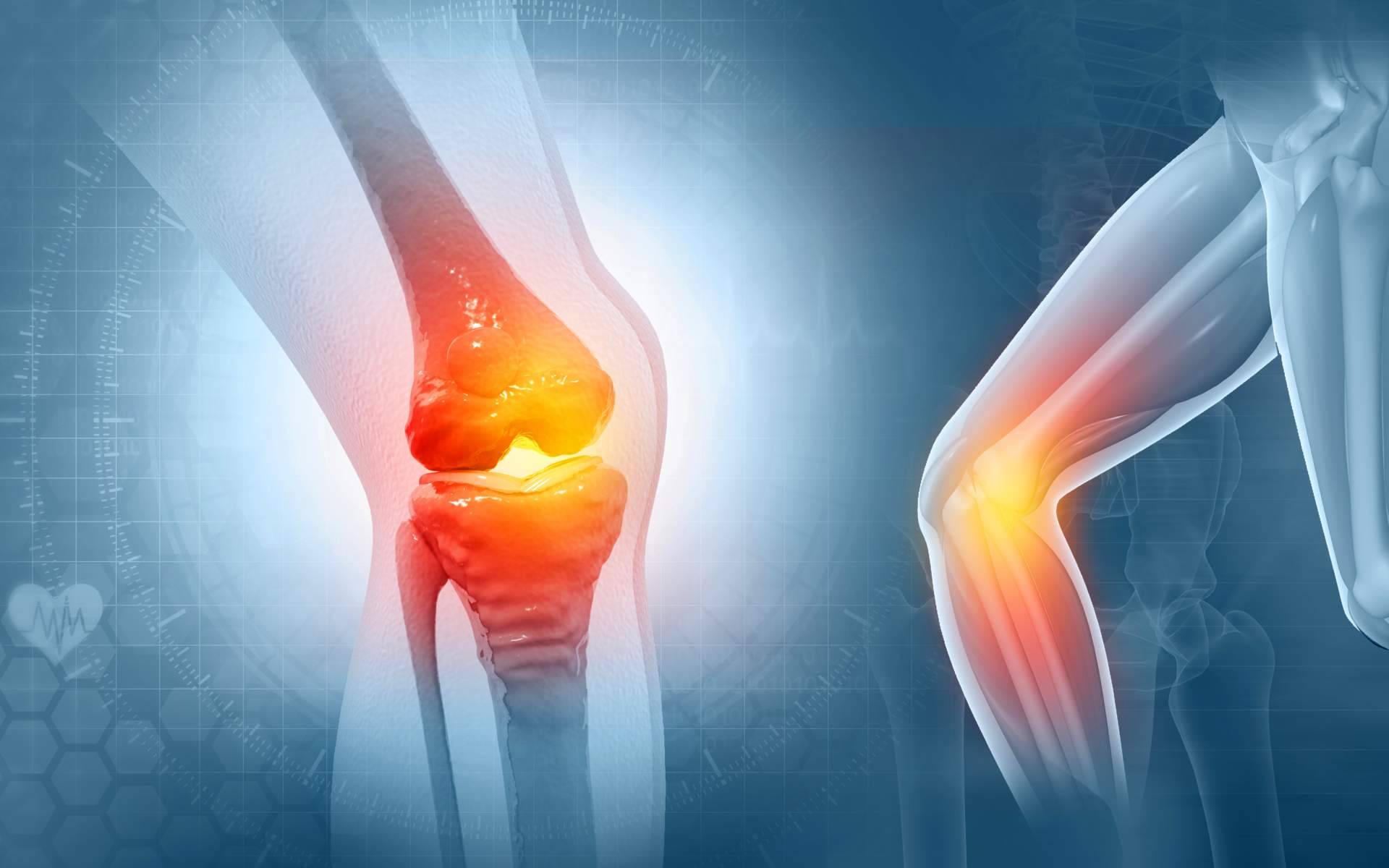 El 7º Congreso Internacional de Pacientes con Artrosis contará con la presencia de iXalud