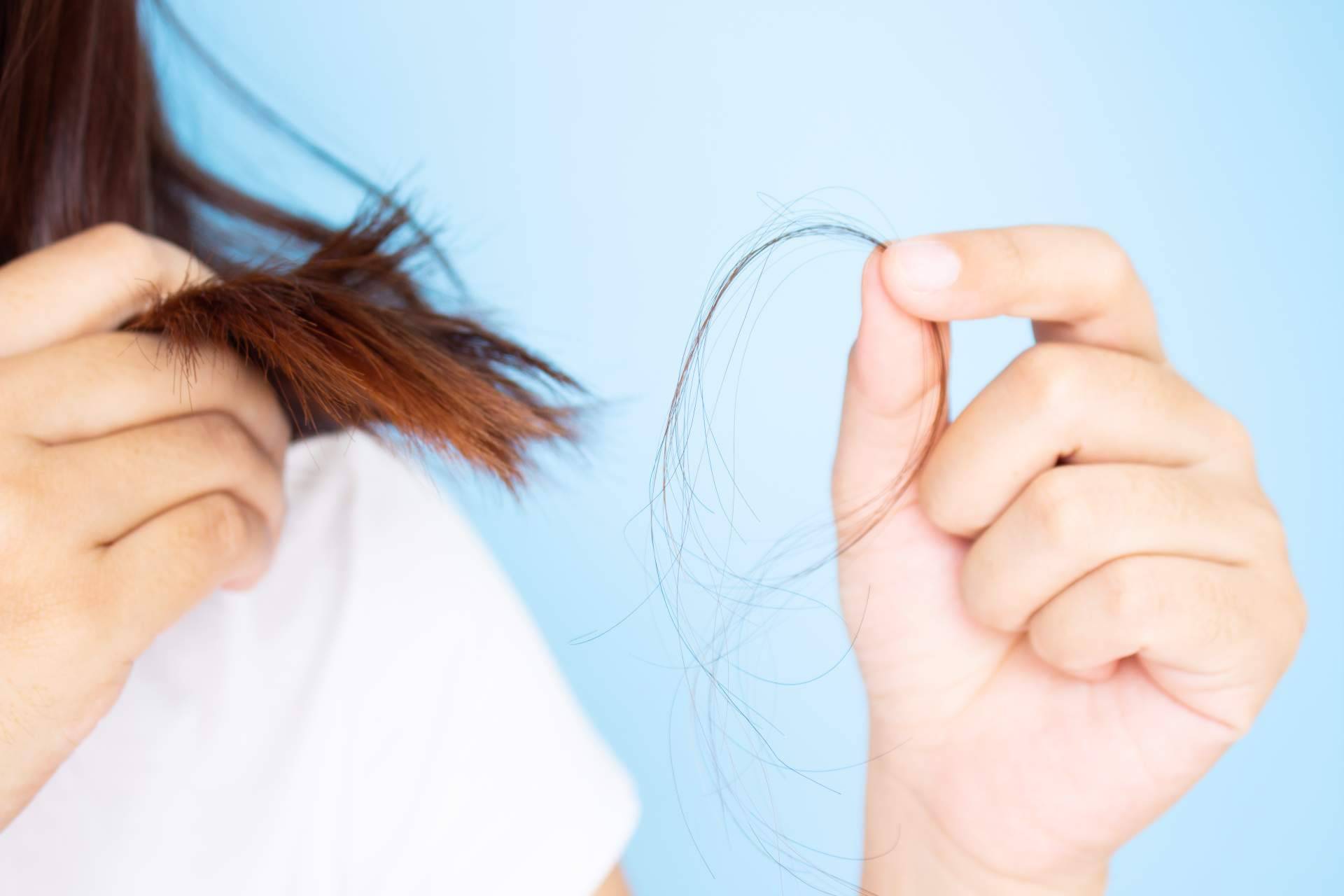 ¿Dónde encontrar champús para prevenir la pérdida de cabello? FarmaSky