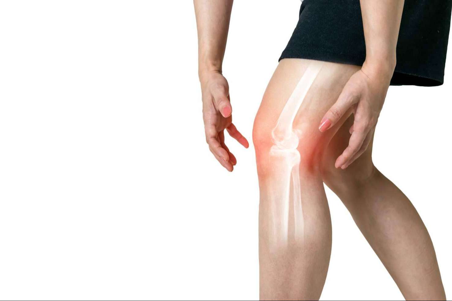iXalud colabora con la asociación de pacientes de artrosis y osteoporosis OAFI