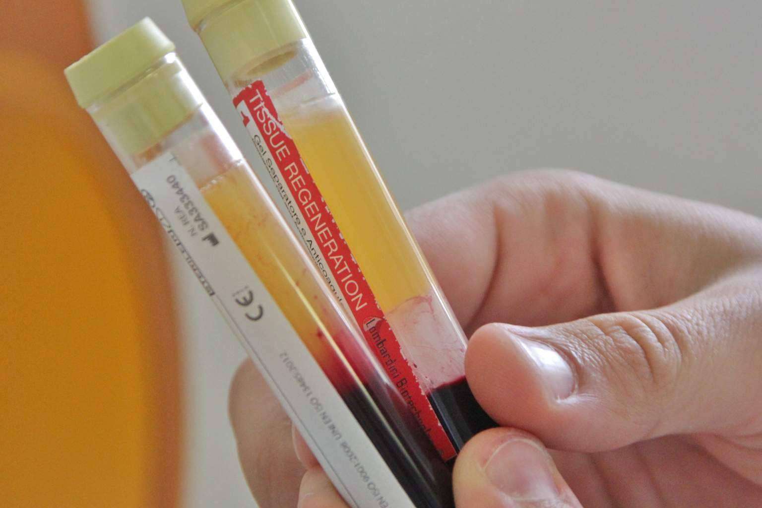 La medicina regenerativa para tratar una enfermedad o lesión, usando las células, tejidos u órganos del paciente