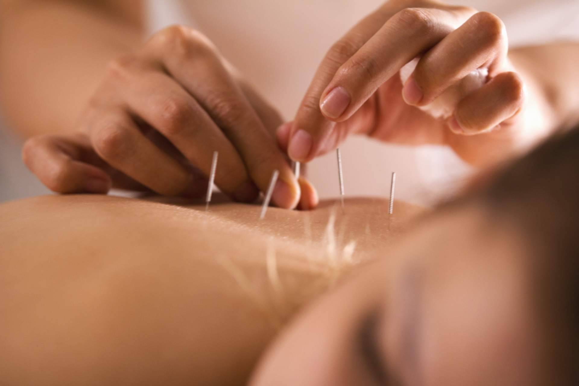 Shenti Wellness afirma que la acupuntura tiene múltiples beneficios para la fertilidad