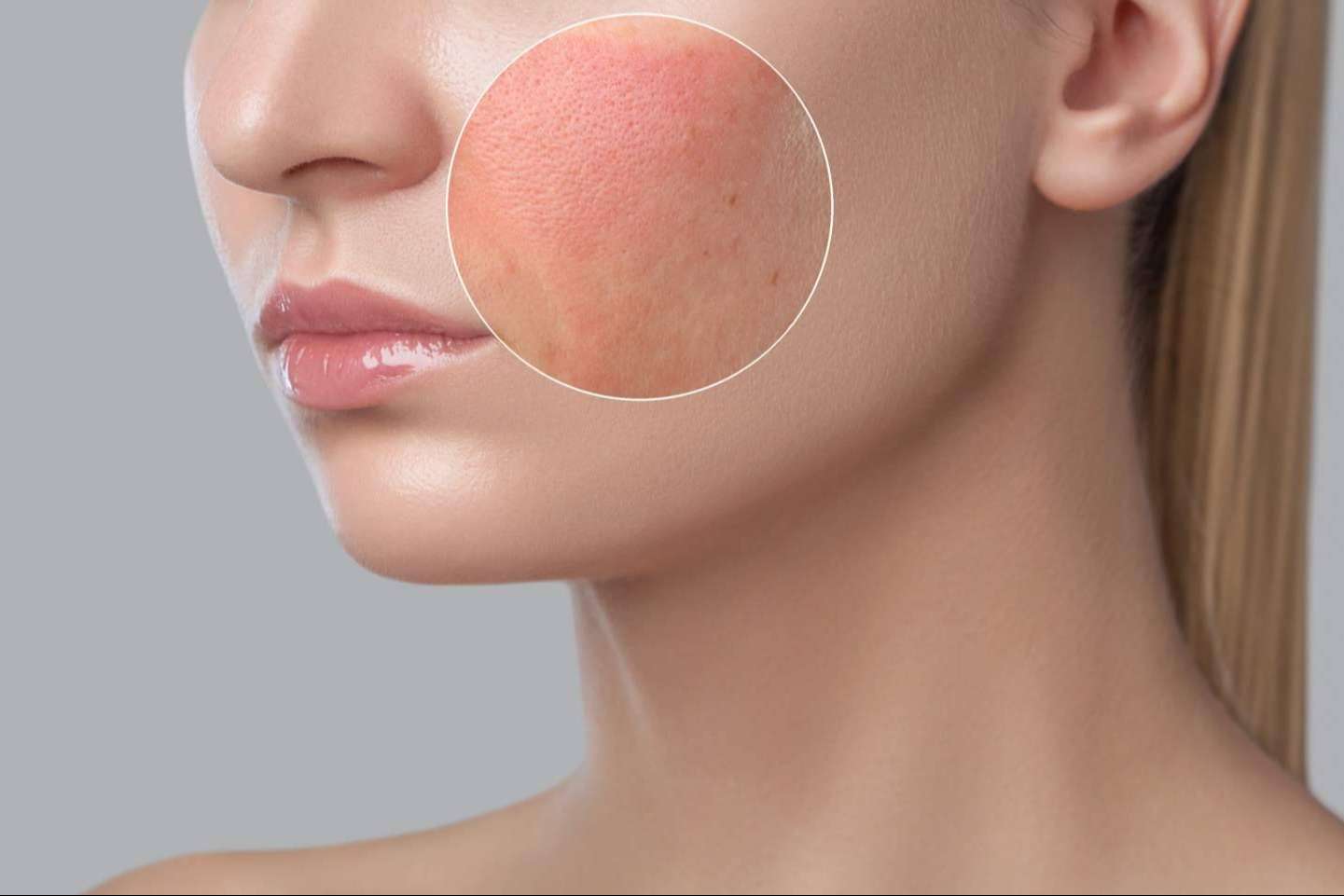 Descubrir la revolución en el cuidado de la piel sensible; bienestar y belleza sin irritaciones