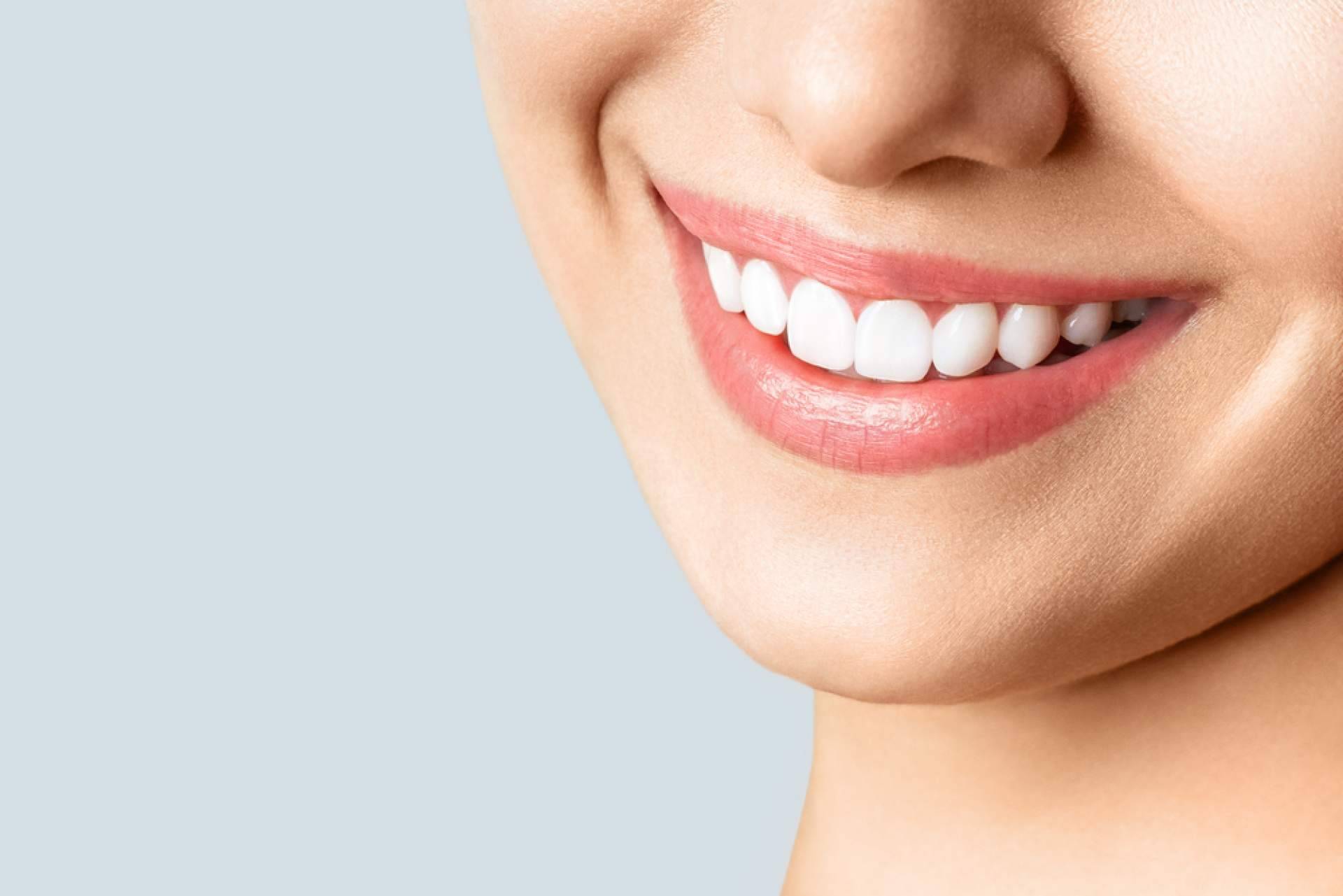 Carlos Saiz Smile ofrece el tratamiento de microcarillas dentales sin tallado dental