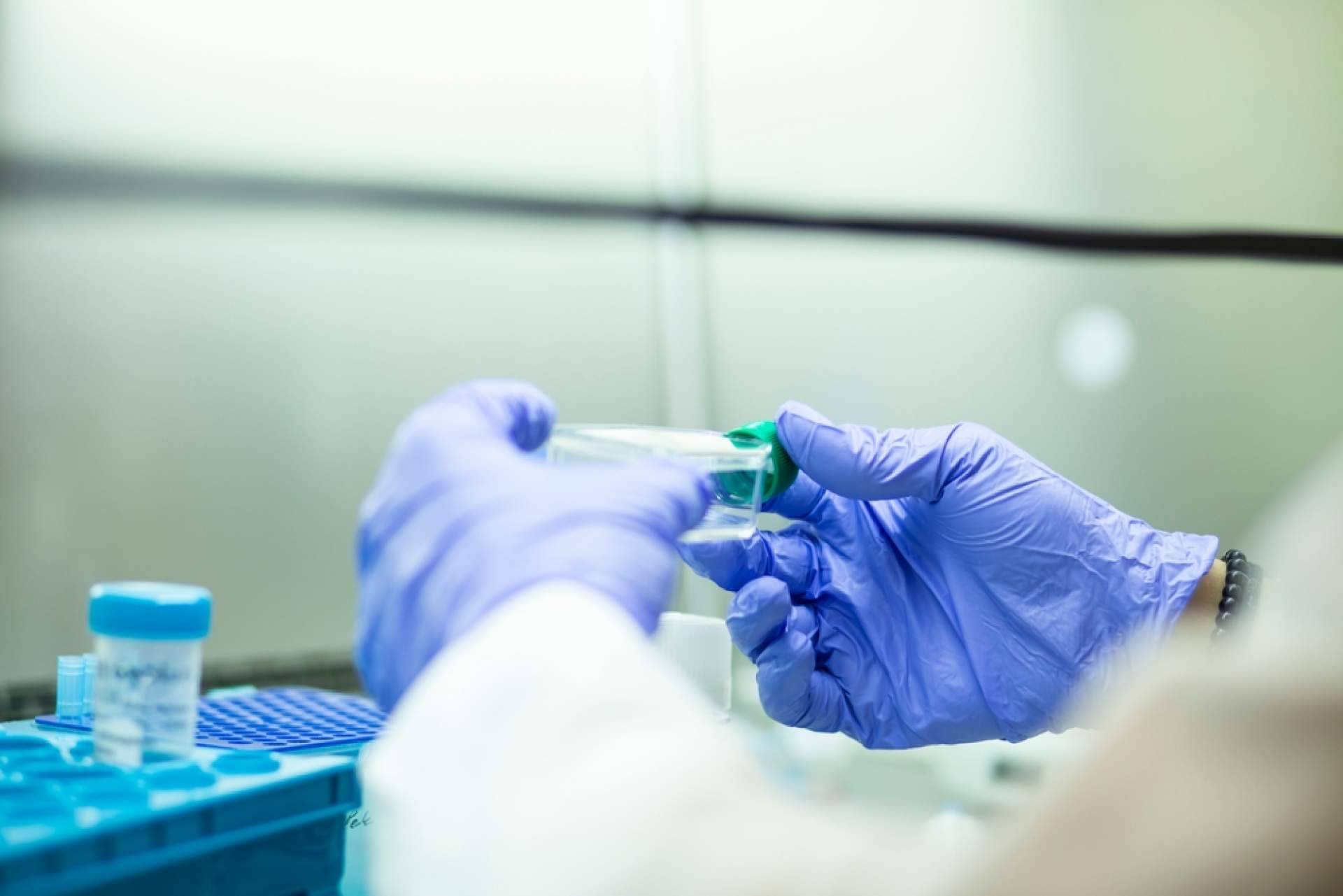 Immunotherapy Regenerative Medicine, especialistas en células madre en México