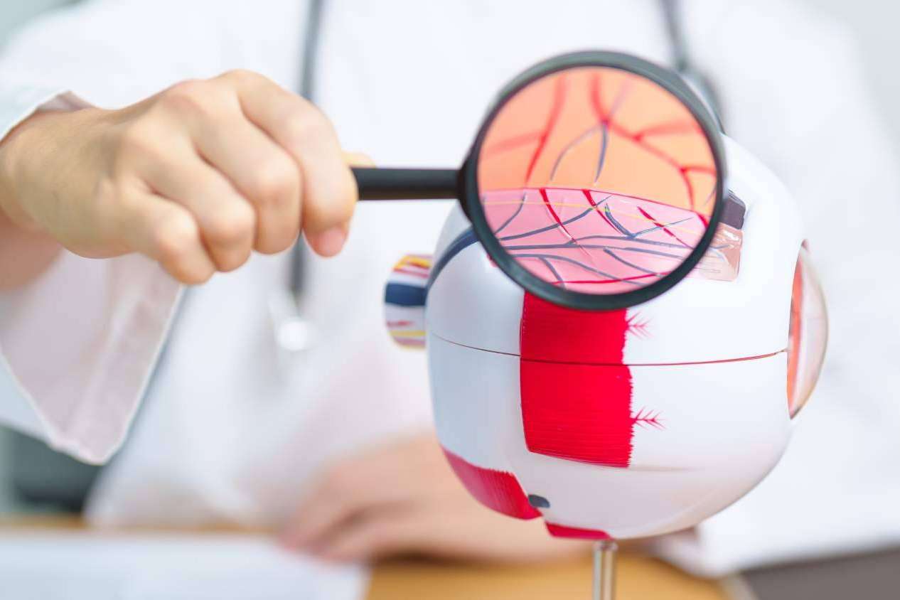 El Departamento de Oftalmología del Instituto Universitario Dexeus habla acerca de la retinopatía diabética